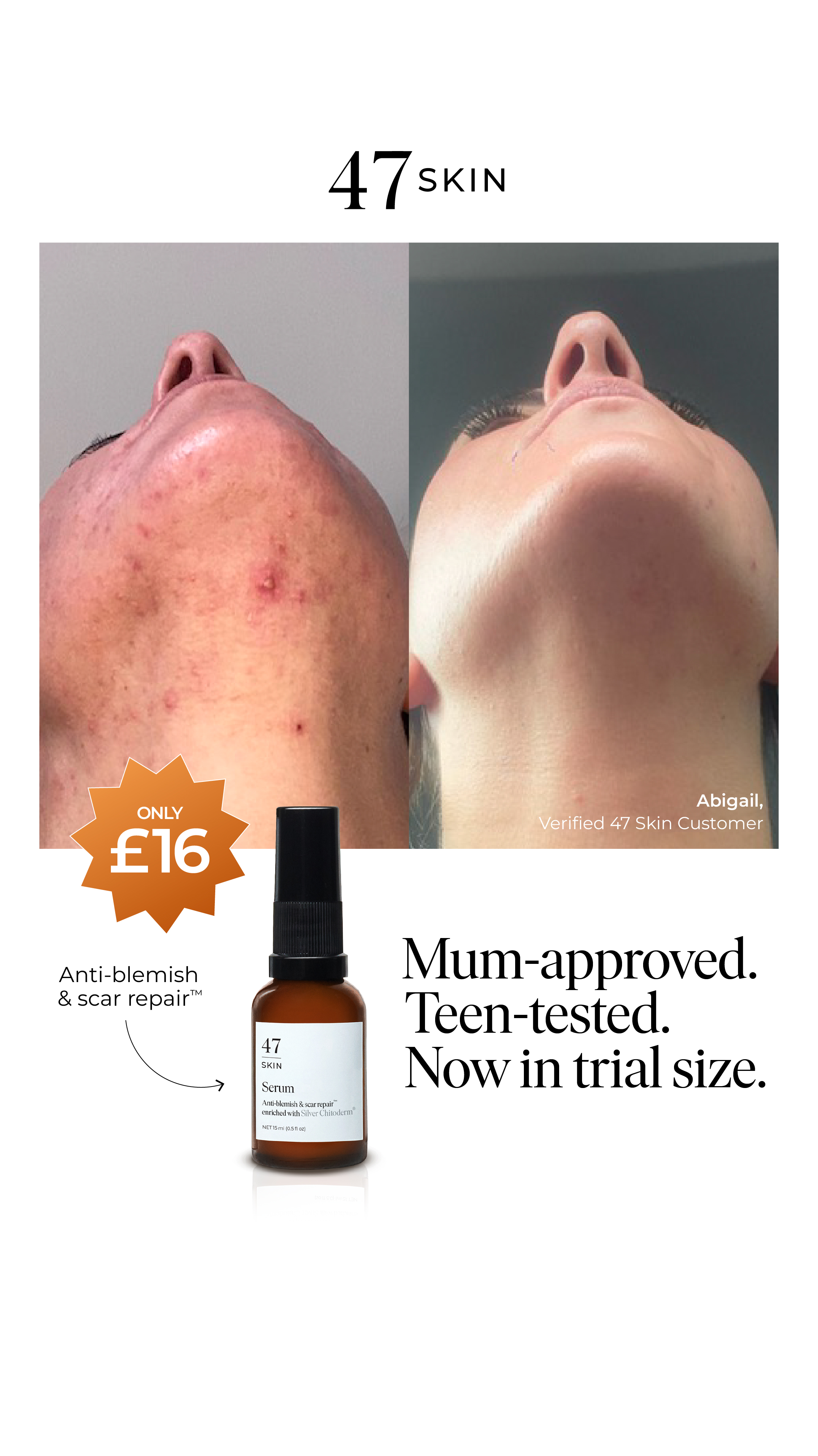 47Skin Facebook ad