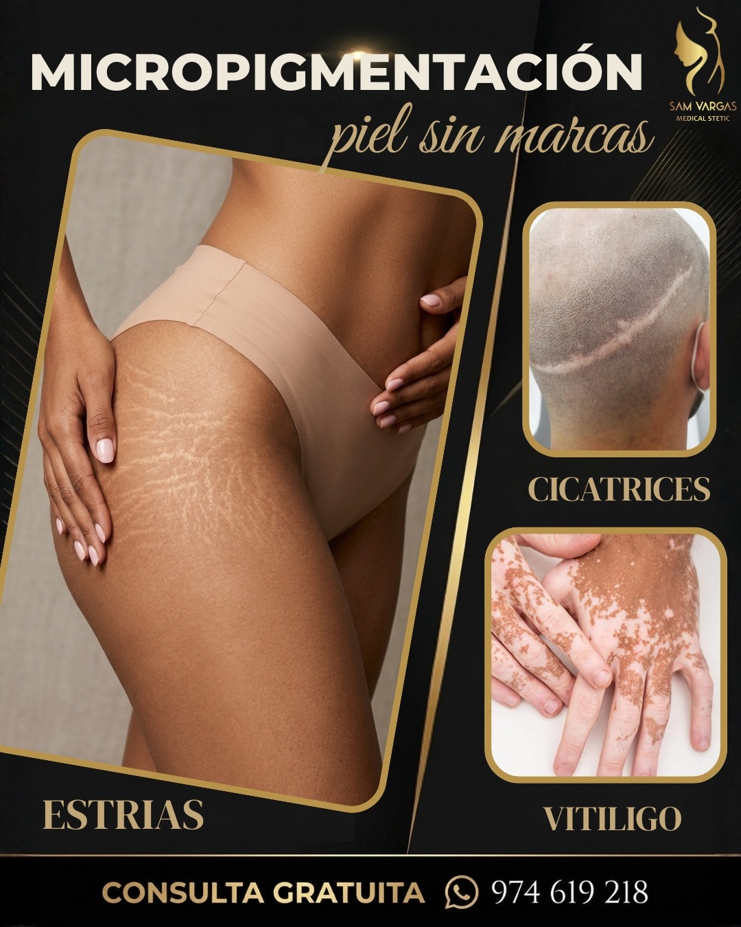 πππ§ππ«π¨ ππ¬πΓ©ππ’ππ¨ ππ§πππ π«ππ₯ πππ¦ πππ«π ππ¬ Facebook ad: Piel Sin Marcas