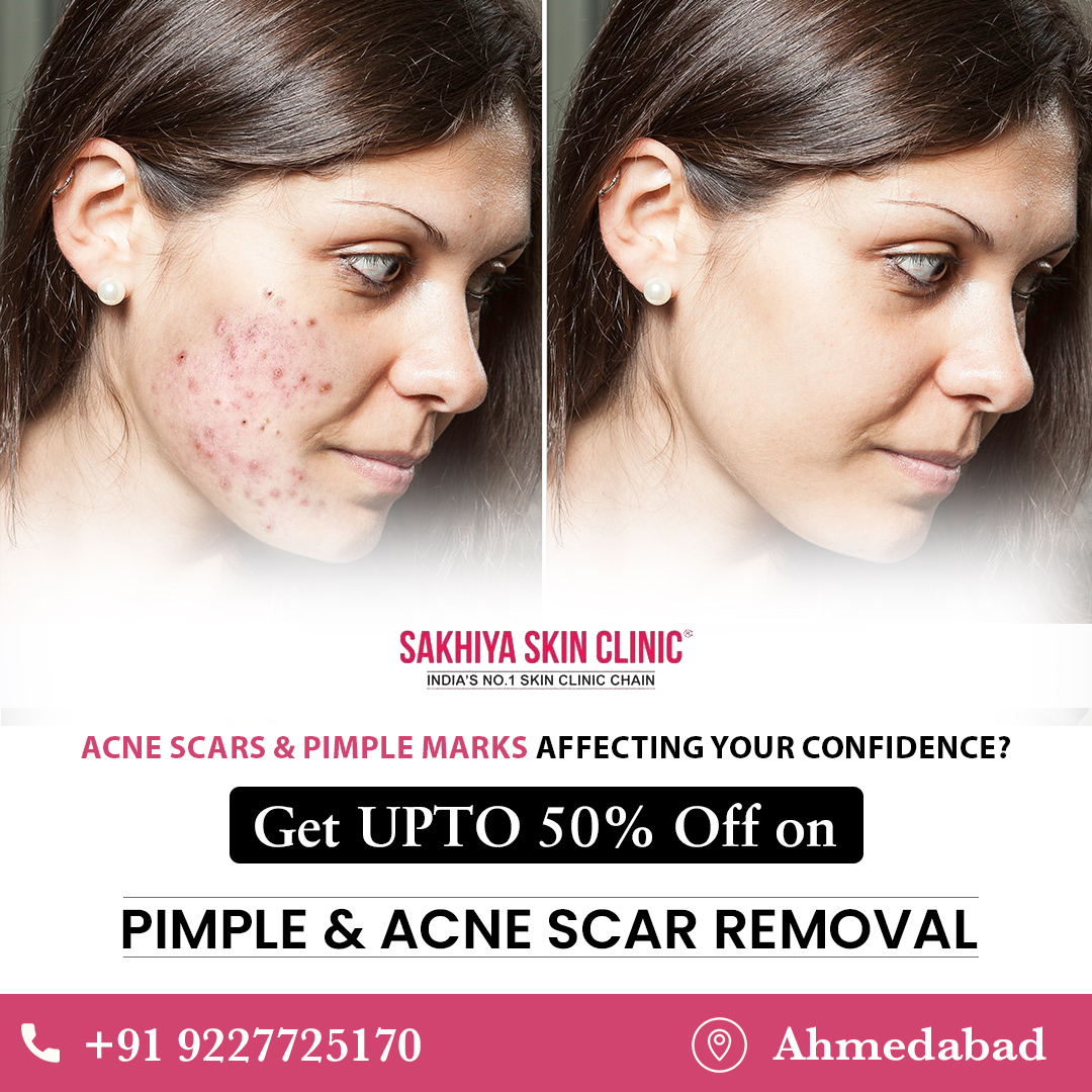 Dr. Jagdish Sakhiya Facebook ad: Special Monthly Offer, Get UPTO 50% OFF