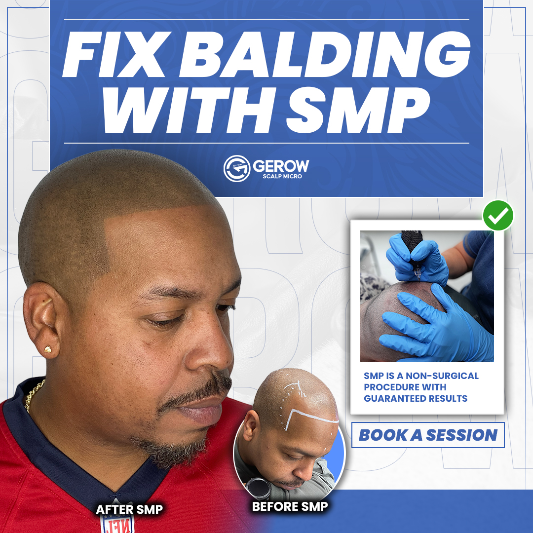 Gerow Hair Ink Facebook ad: Houston, Stop Hair Loss Without Surgery