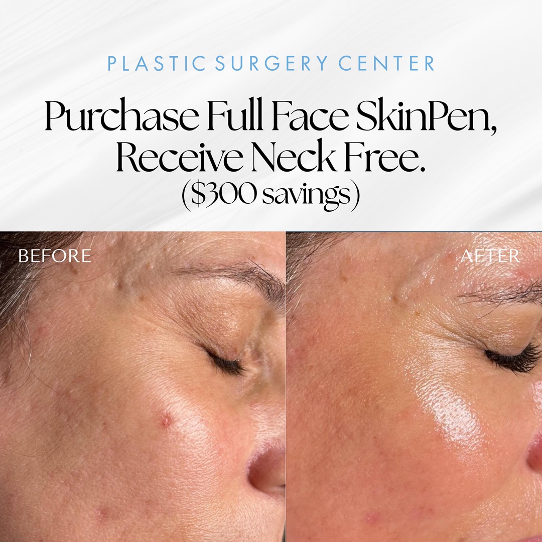 Plastic Surgery Center Wichita Facebook ad: Refresh your skin with Full Face SkinPen &…