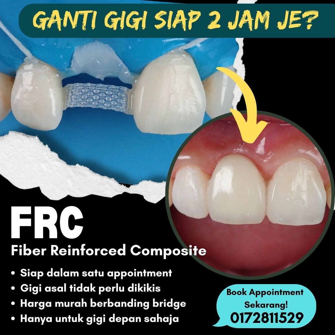 Klinik Pergigian Dr Asri Facebook ad: Ganti gigi hilang dengan cepat dan mudah!
