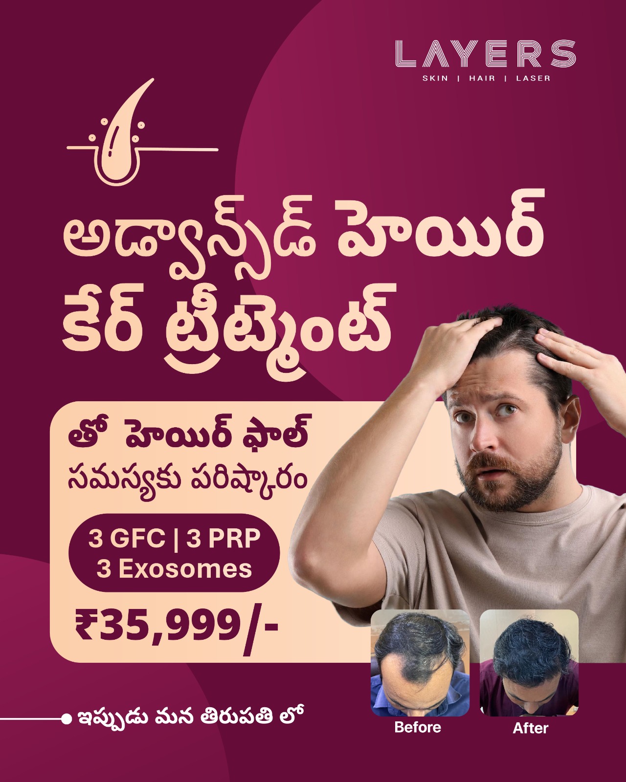 Layers Clinics - Skin & Hair Facebook ad