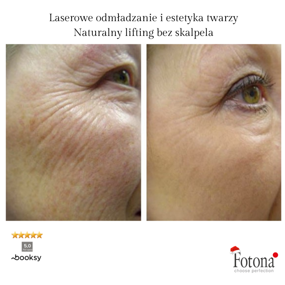 BeautyPark Solvay Facebook ad