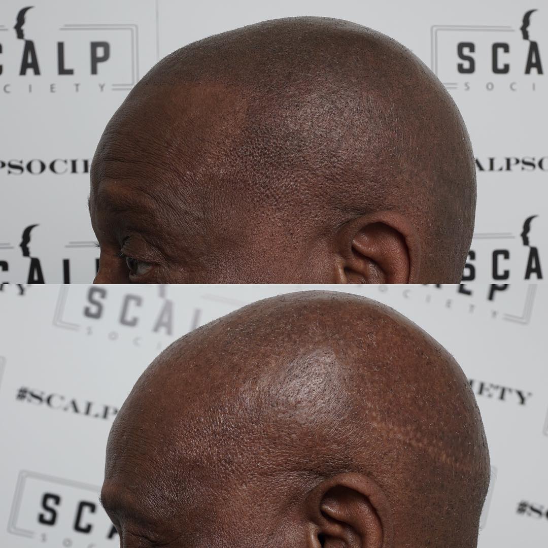 Scalp Society - Scalp Micropigmentation Clinic Facebook ad
