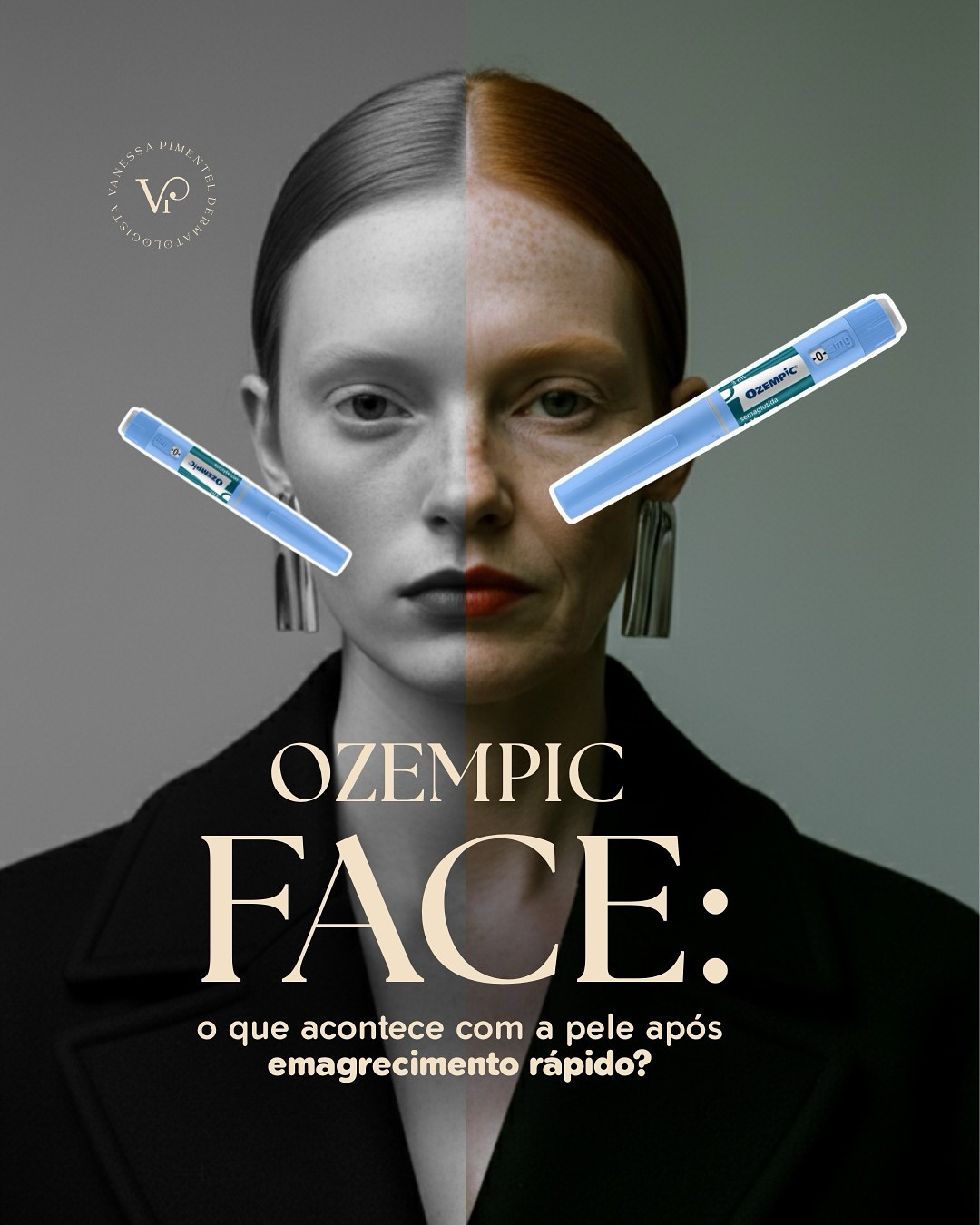 Dra. Vanessa Pimentel Facebook ad: Você já ouviu falar em Ozempic Face?