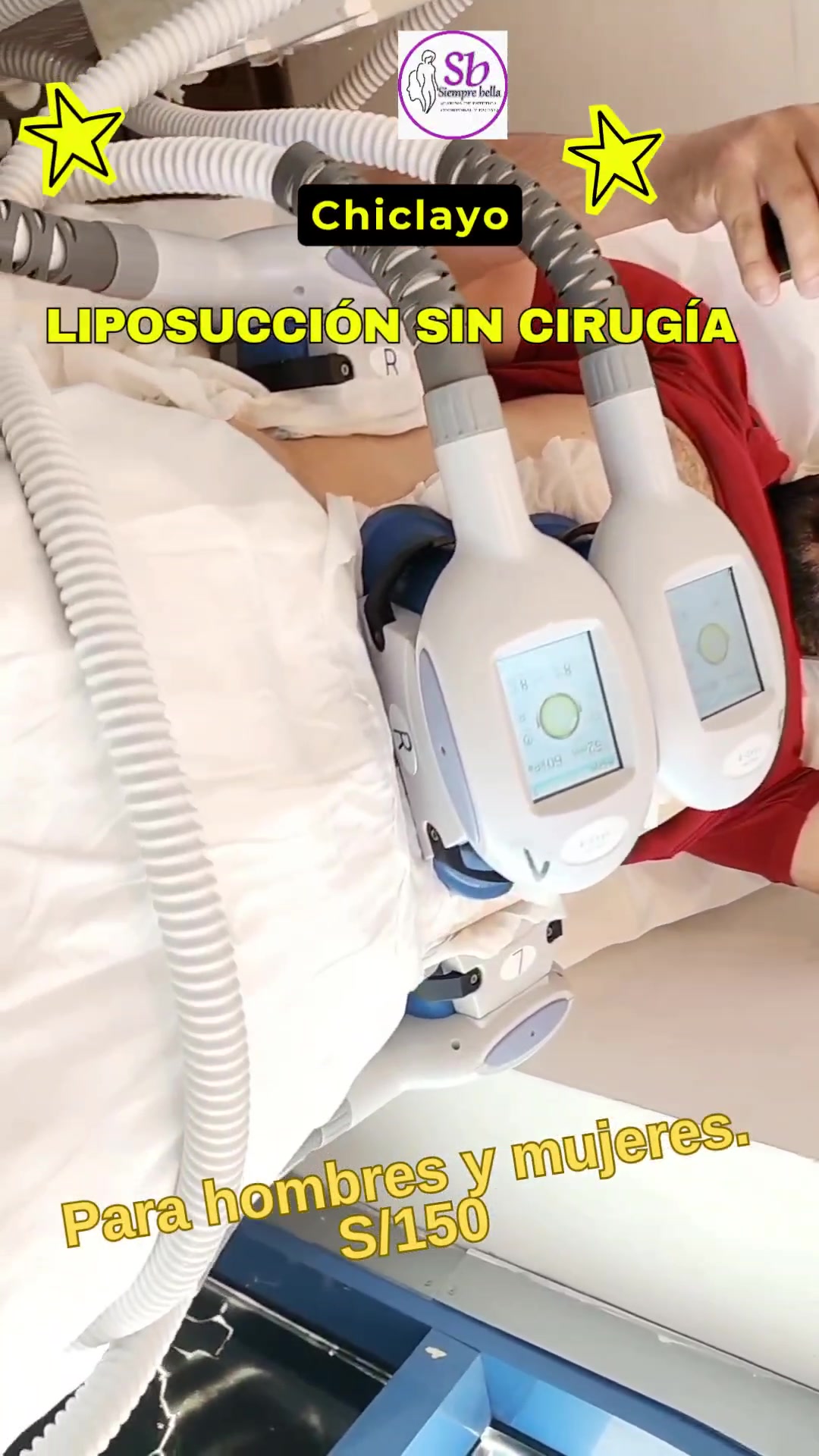 Siempre Bella Facebook ad: LIPOSUCCIÓN SIN CIRUGÍA CON CRIOLIPÓLISIS 360