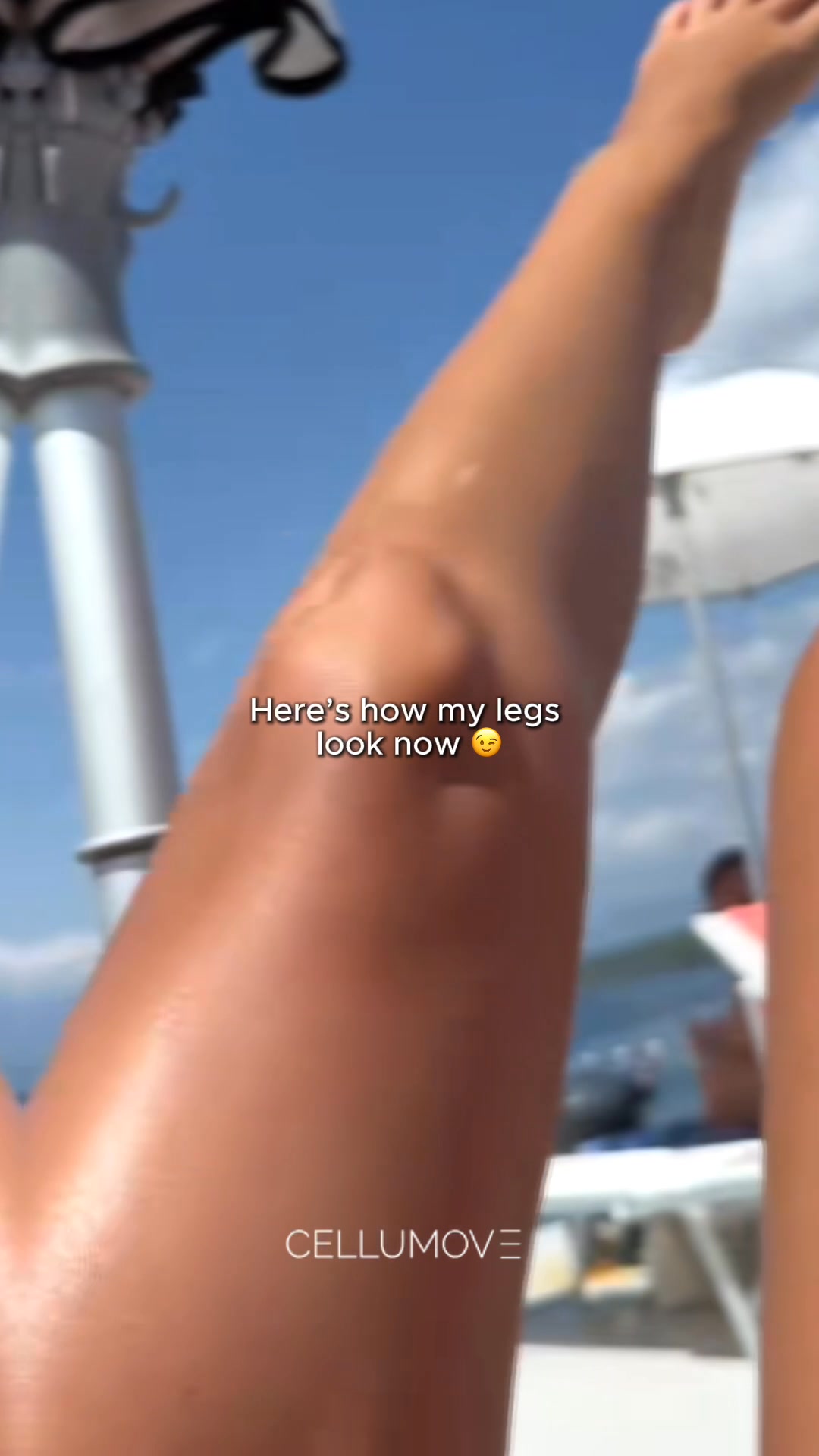 Cellumove Facebook ad: Show Your Legs with Confidence!