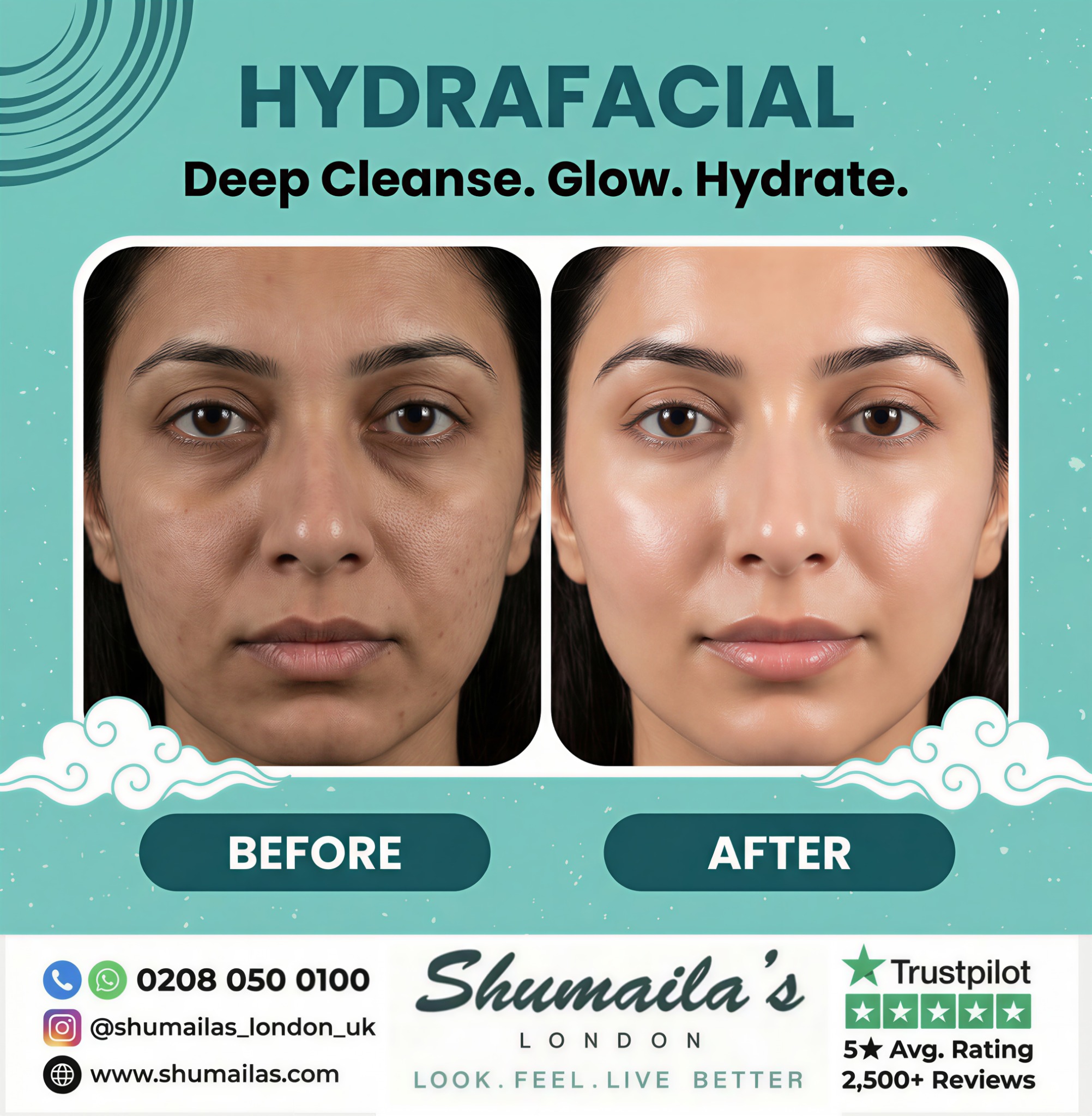 Shumaila's London Aesthetic and Laser Clinics Facebook ad