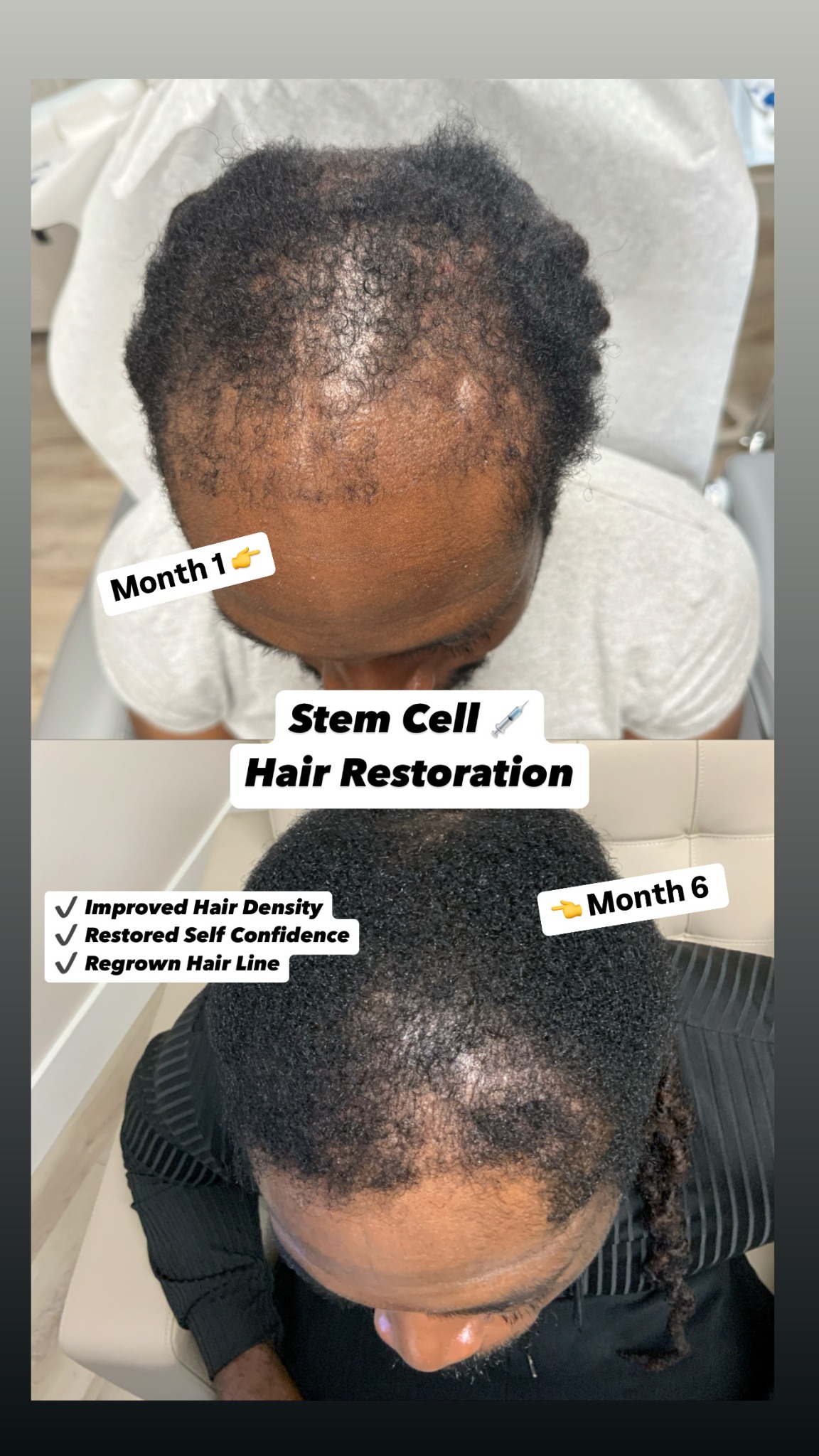 Arizona Aesthetics Facebook ad: Regrow Your Hair Using Stem Cells.