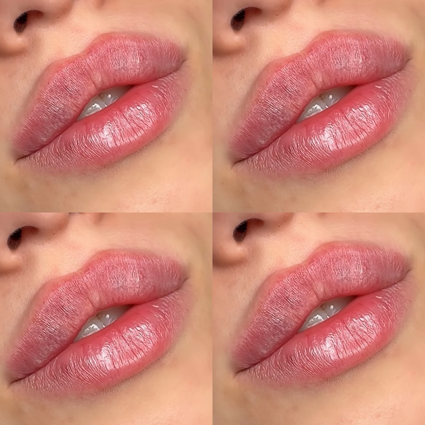 Uderma med spa Facebook ad: The Russian Lip Technique: What Makes It Special
