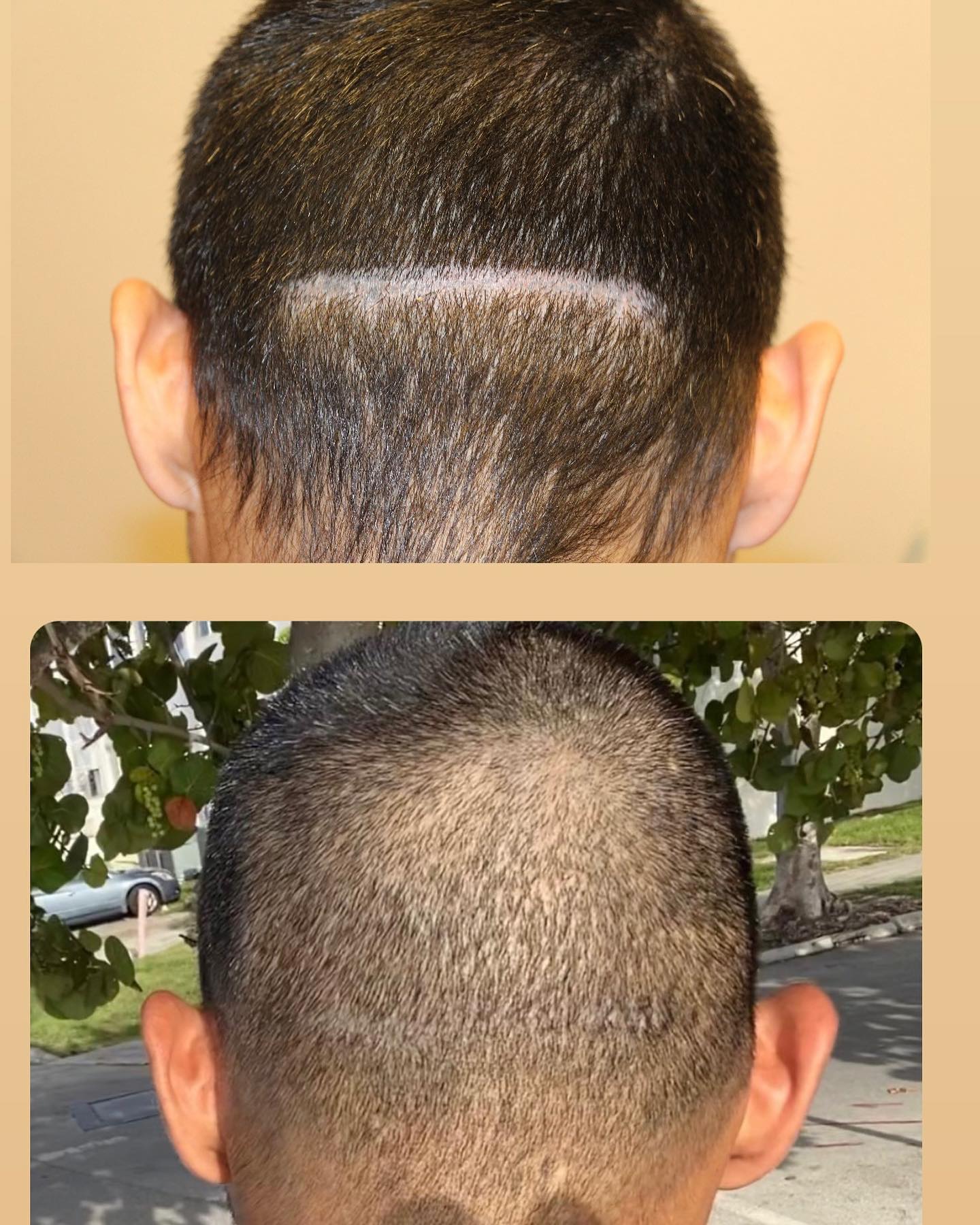 Modena Hair Institute Facebook ad