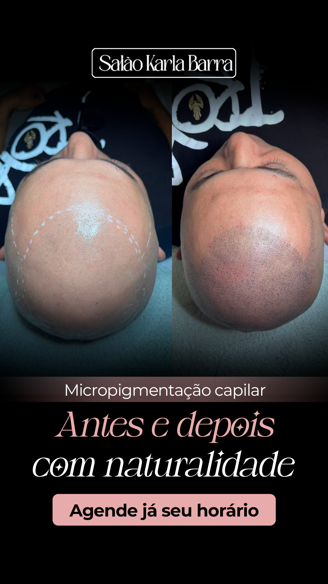 Karla Barra - Fábrica de Loiras Facebook ad from Mar 3, 2026