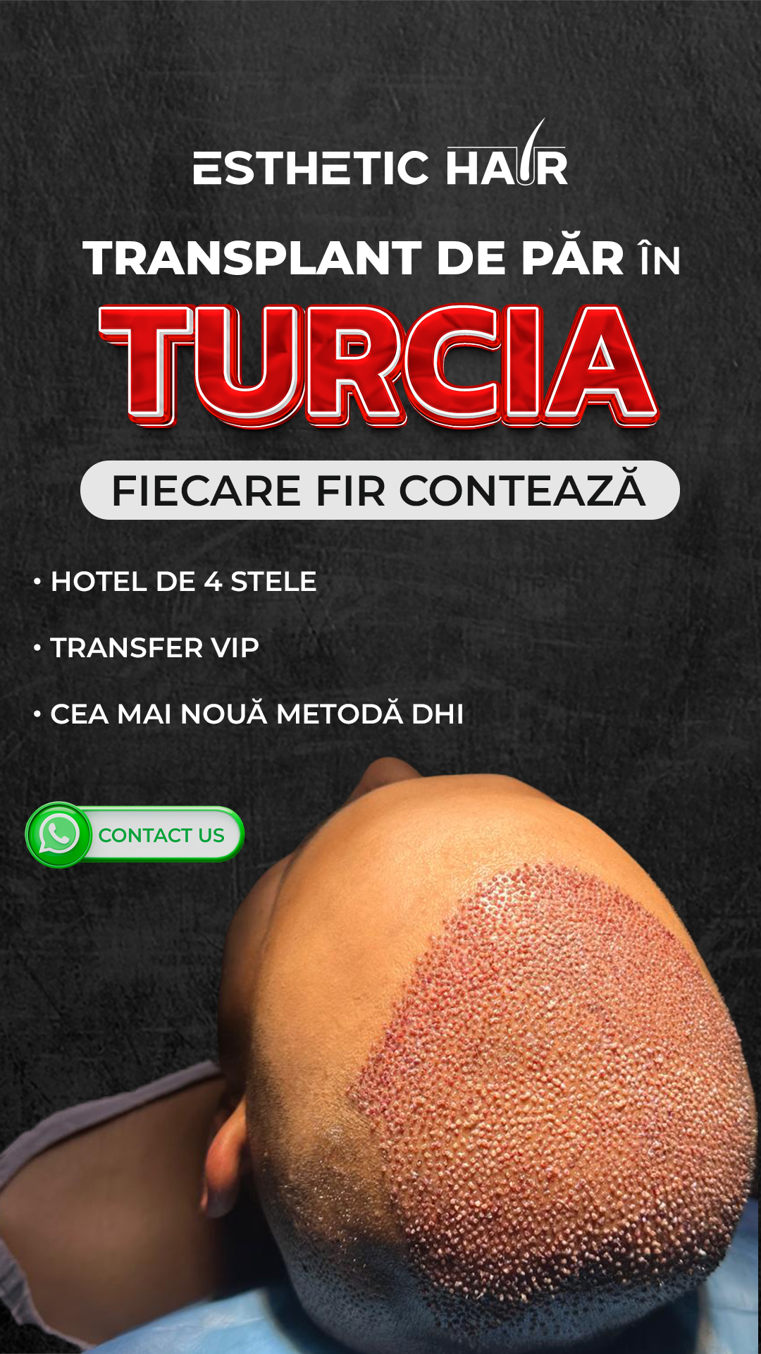 Esthetic Hair Turkey Facebook ad