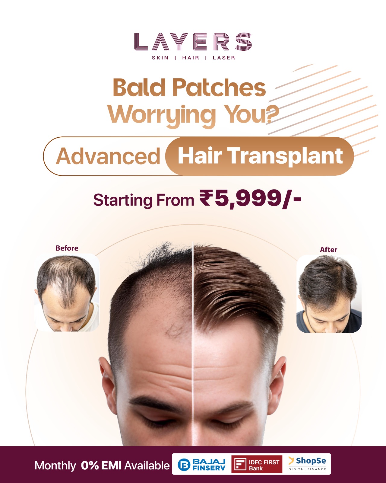 Layers Clinics Facebook ad