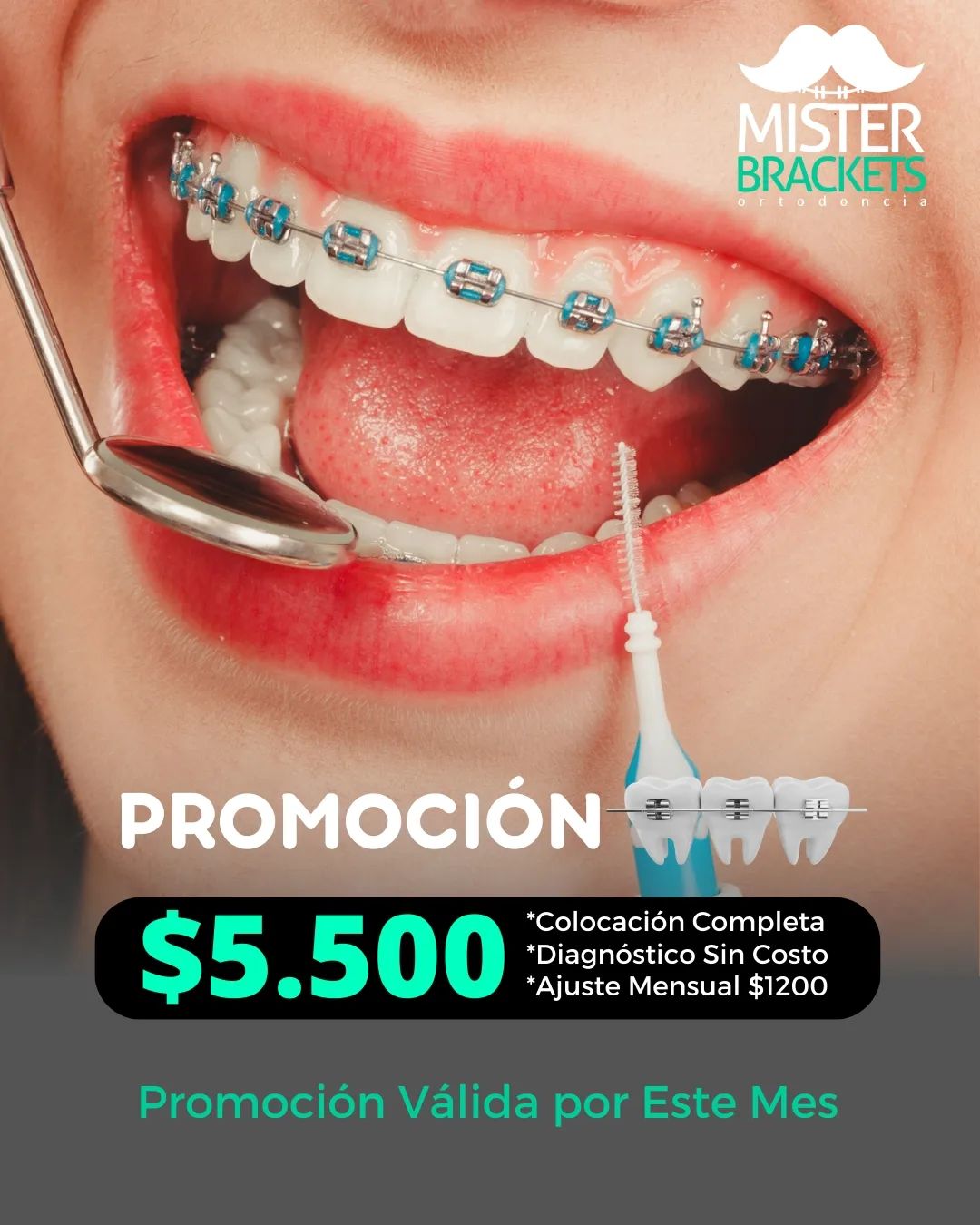 Mr. Brackets Ortodoncia Facebook ad: Promoción Brackets