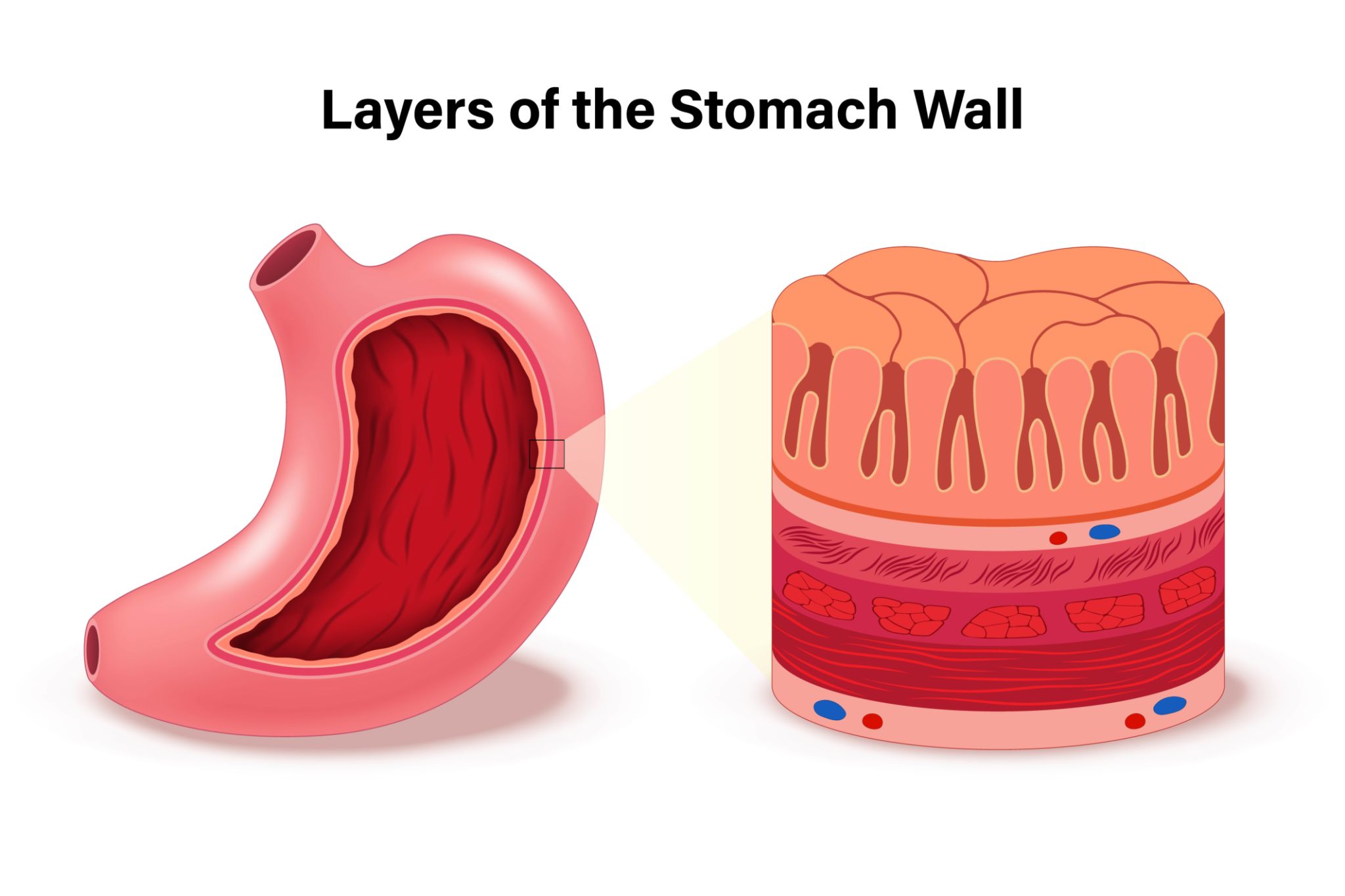 My Esophagus and Me Facebook ad