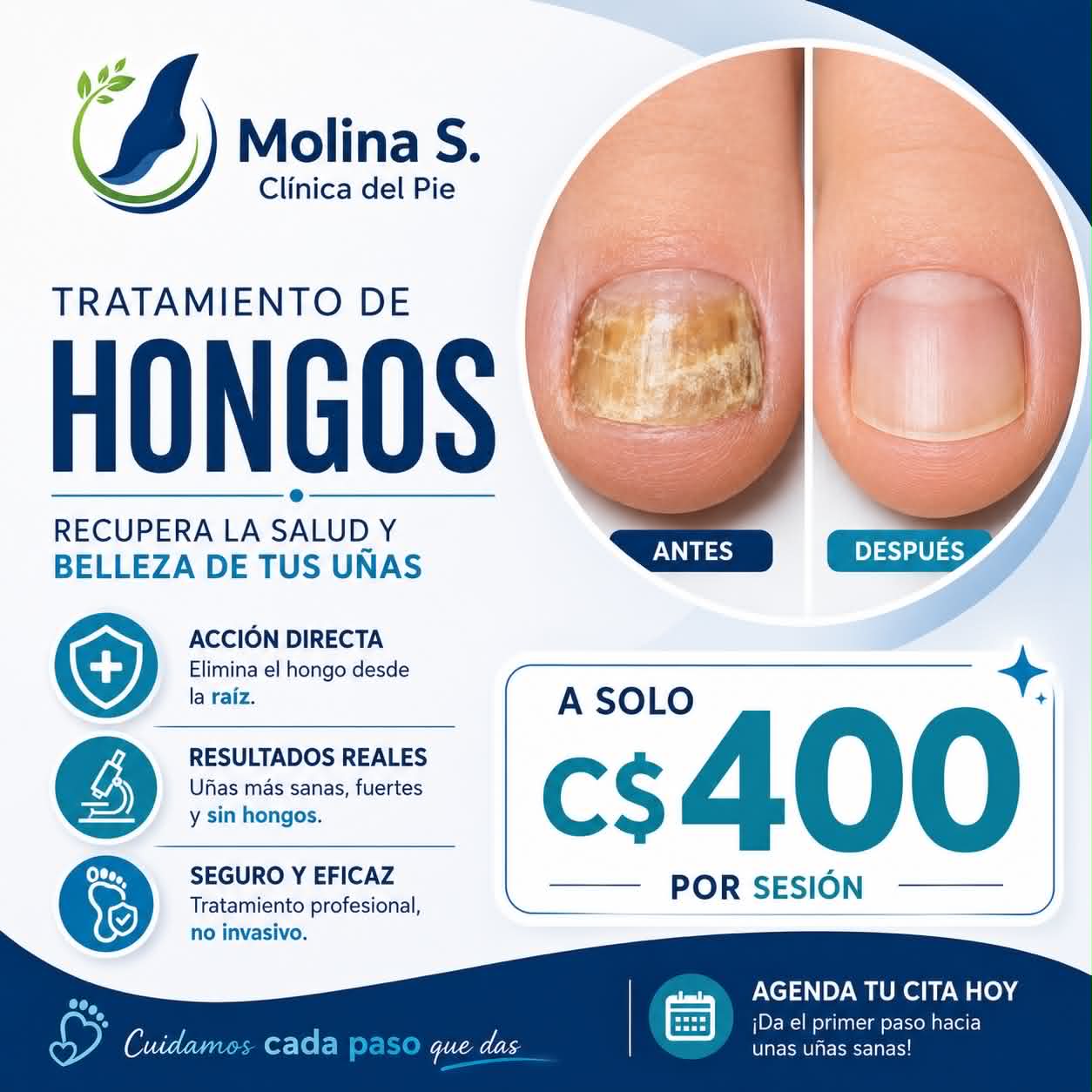 Clínica Podologica Molina Facebook ad: Luce tus uñas sanas y naturales!