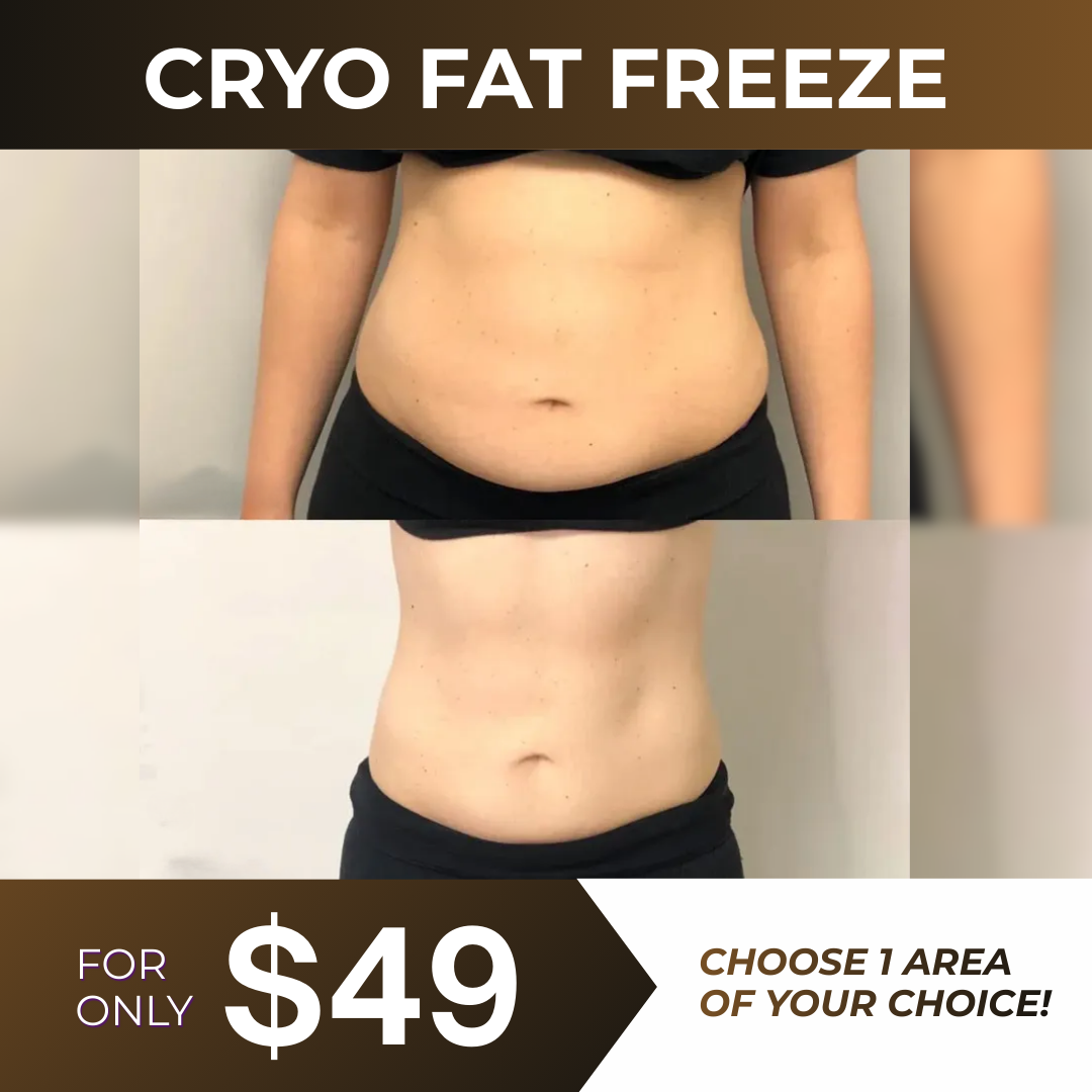 I Love Skin Treatments Facebook ad