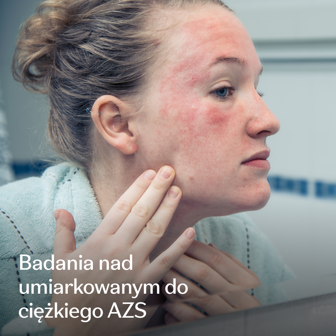 Eczema Research Study Facebook ad: Rejestracja do badania klinicznego