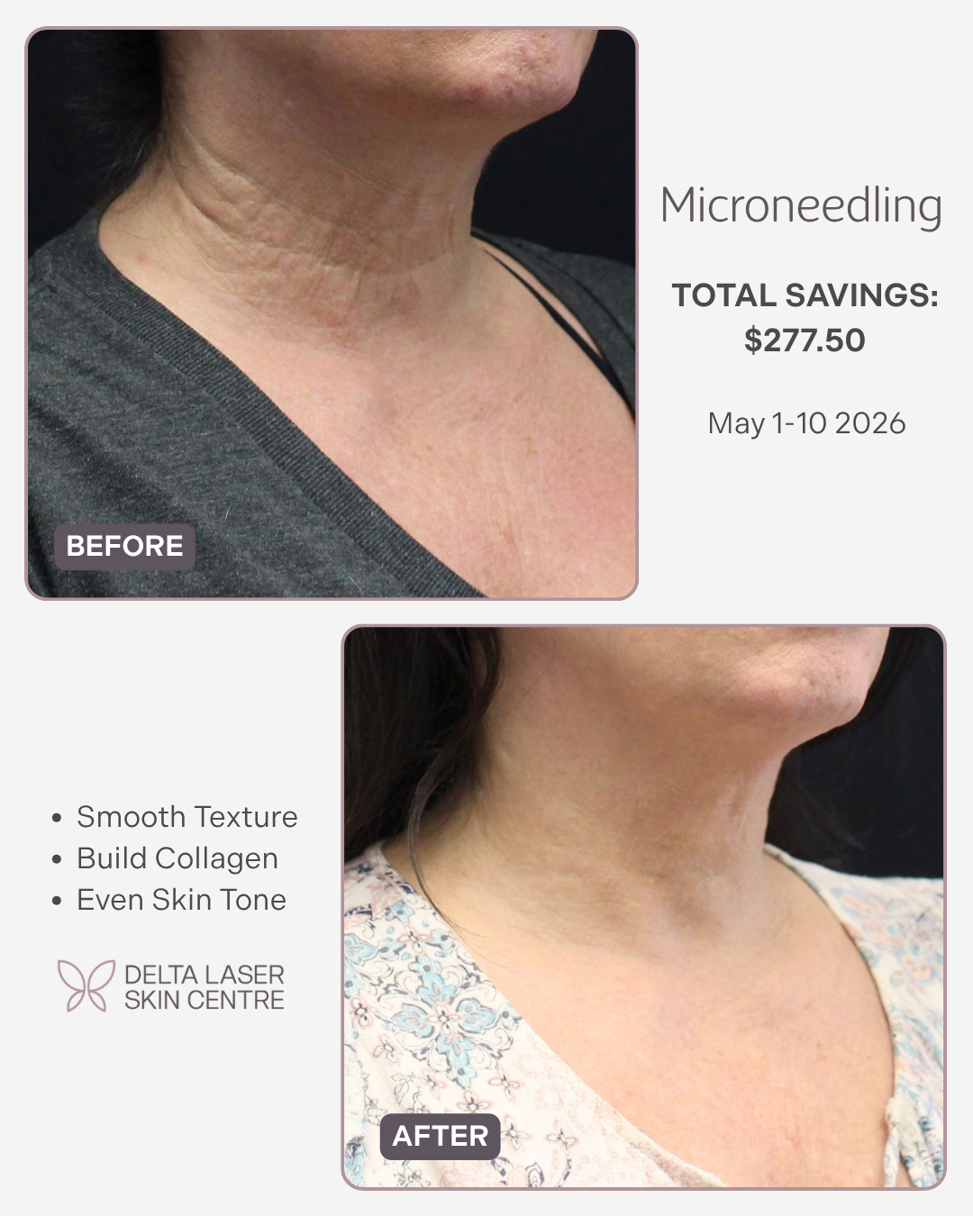 Delta Laser & Skin Care Centre Facebook ad: Our Annual Spring Sale is here!