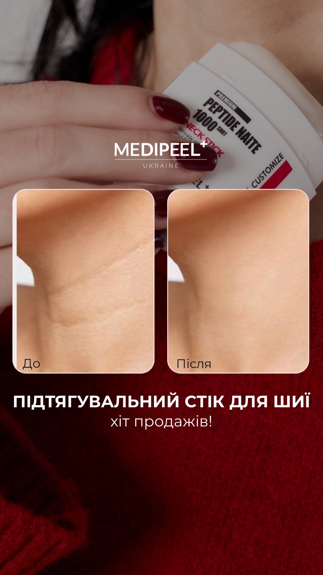 Medipeel Україна Facebook ad: Омолодження шиї за 1 крок