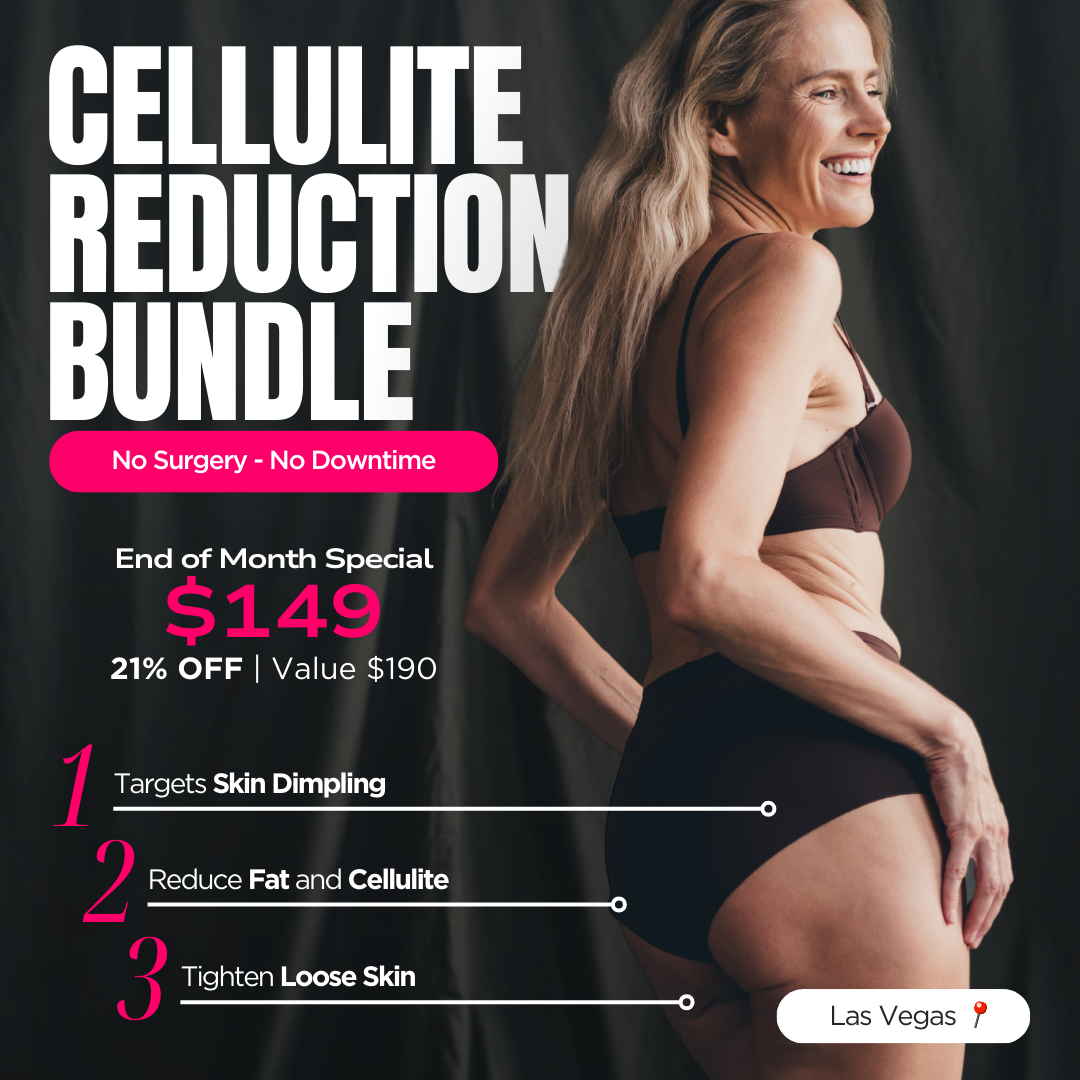 Redefine Studios Las Vegas Facebook ad: 4-in-1 Anti-Cellulite Treatment For $149!