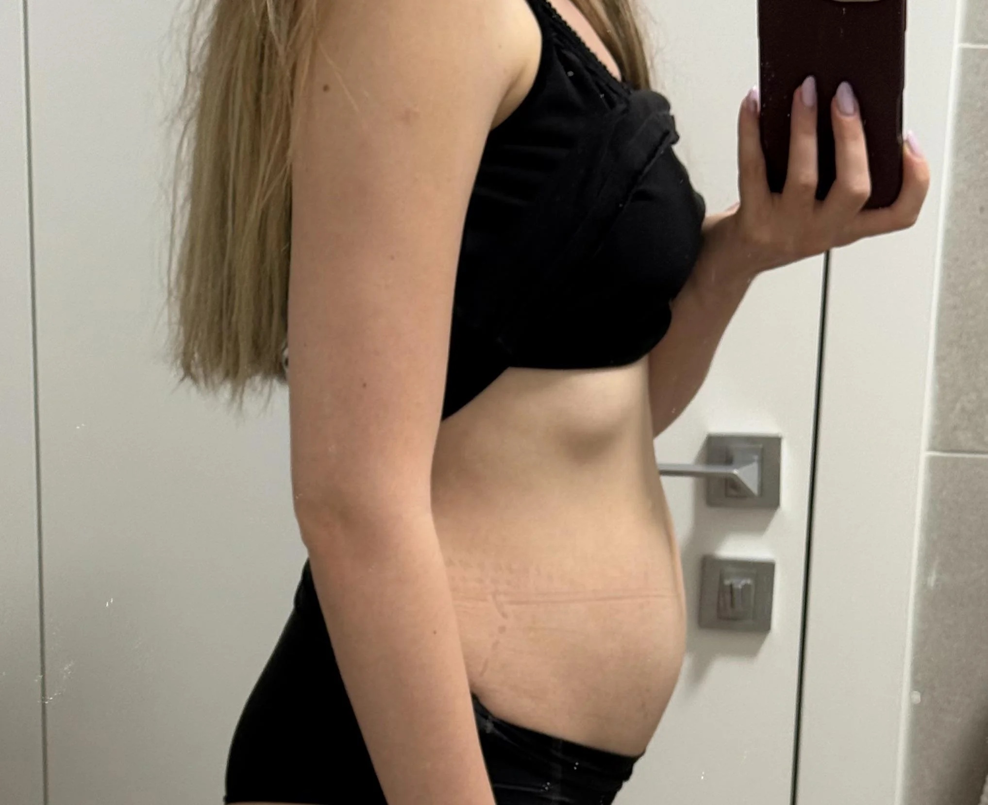 Lymphologist - Allison James, PhD Facebook ad