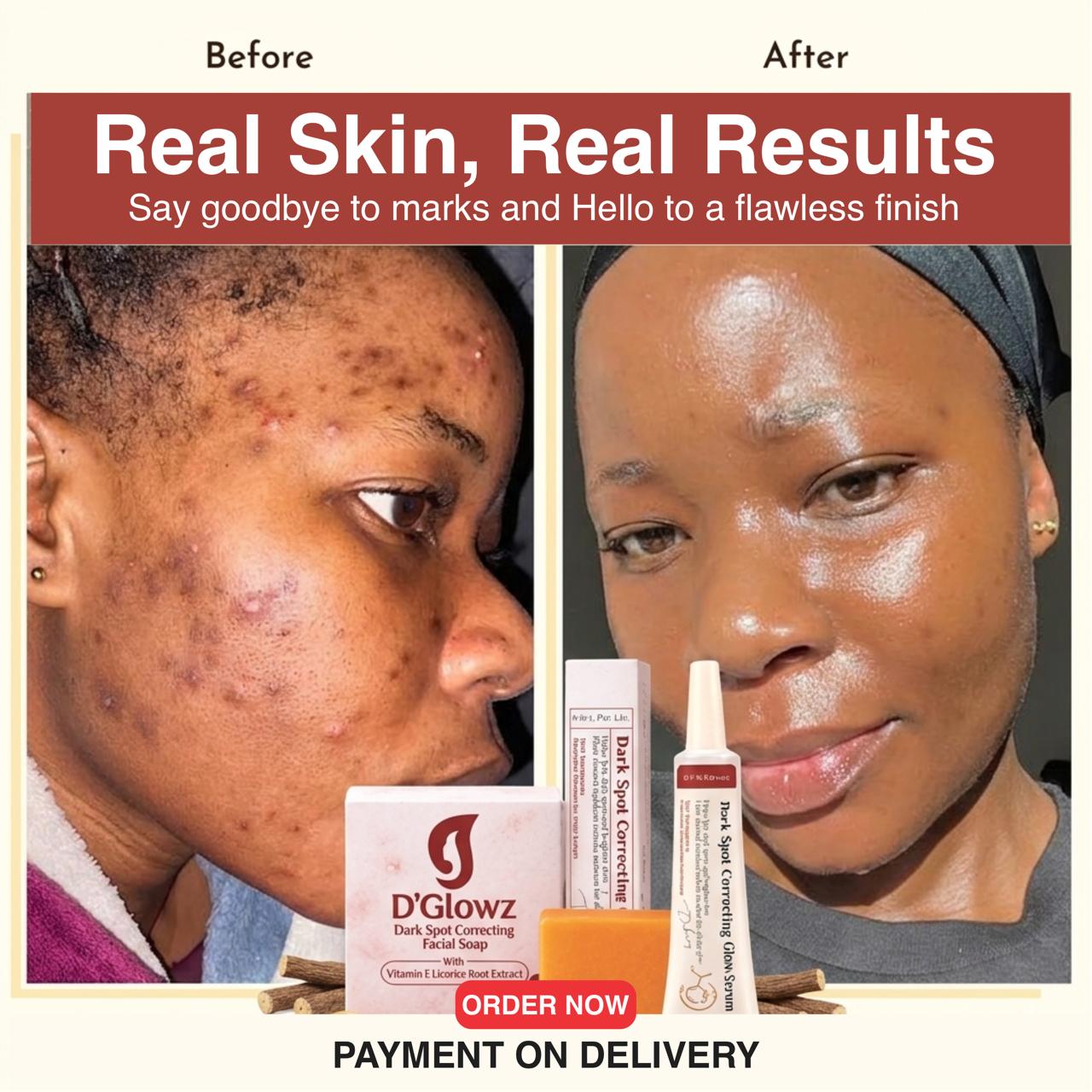 D'Glowz Skincare Facebook ad: If your dark spots refuse to go, try this!