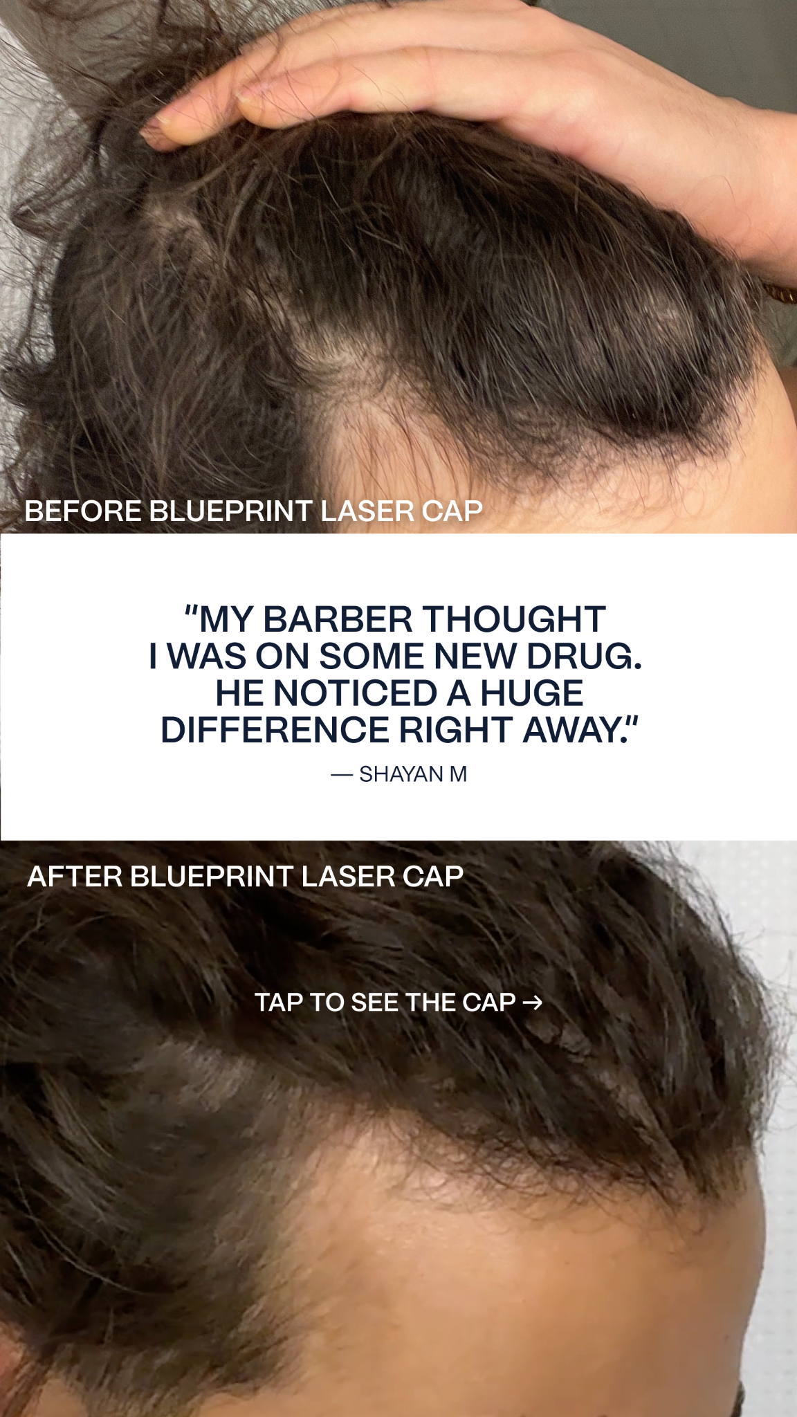 Blueprint Longevity Facebook ad: Reverse hair loss in 16 weeks.