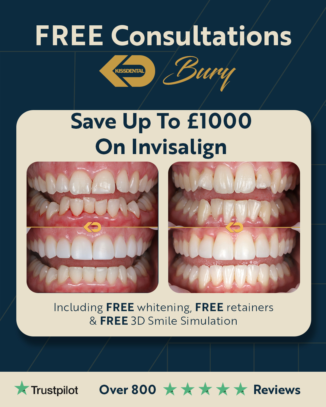 Kissdental Cosmetic Dentistry Facebook ad