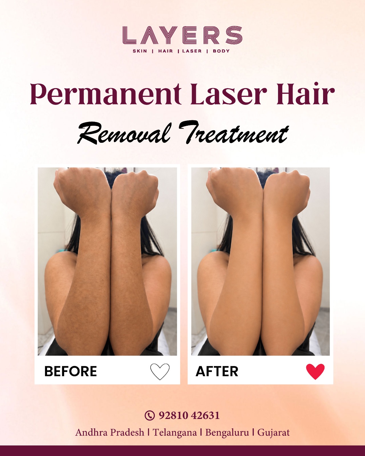 Layers Clinics Facebook ad