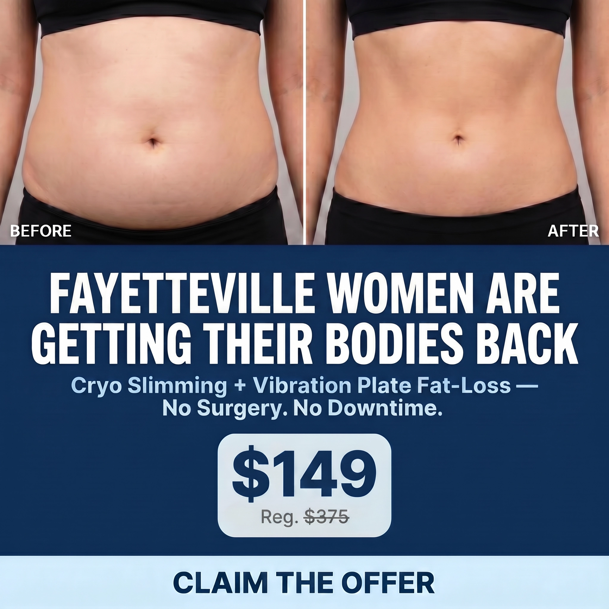 Zivel Fayetteville Facebook ad: Non-Invasive Fat Reduction - Only $149