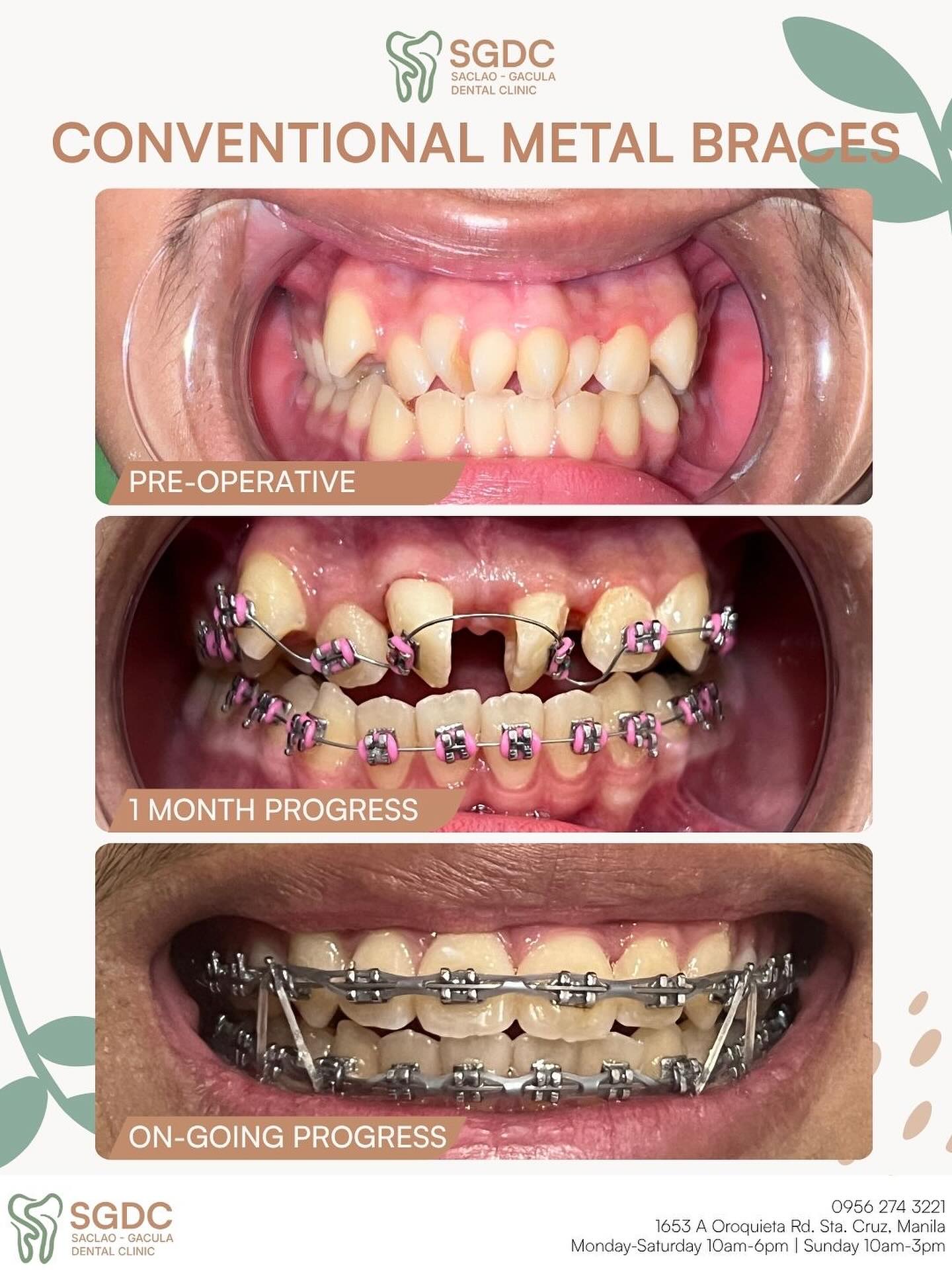 SGDC - Manila Facebook ad: A smile transformation in progress!