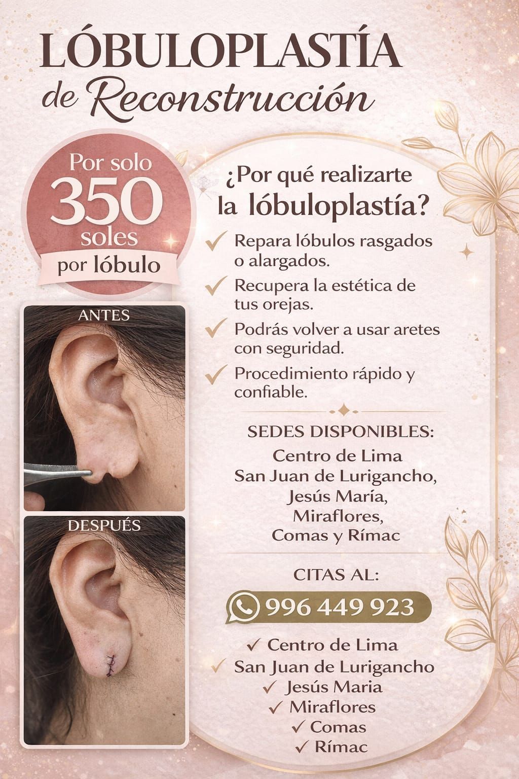 Belleza Latina Peru Facebook ad: LÓBULOPLASTÍA DE RECONSTRUCCIÓN