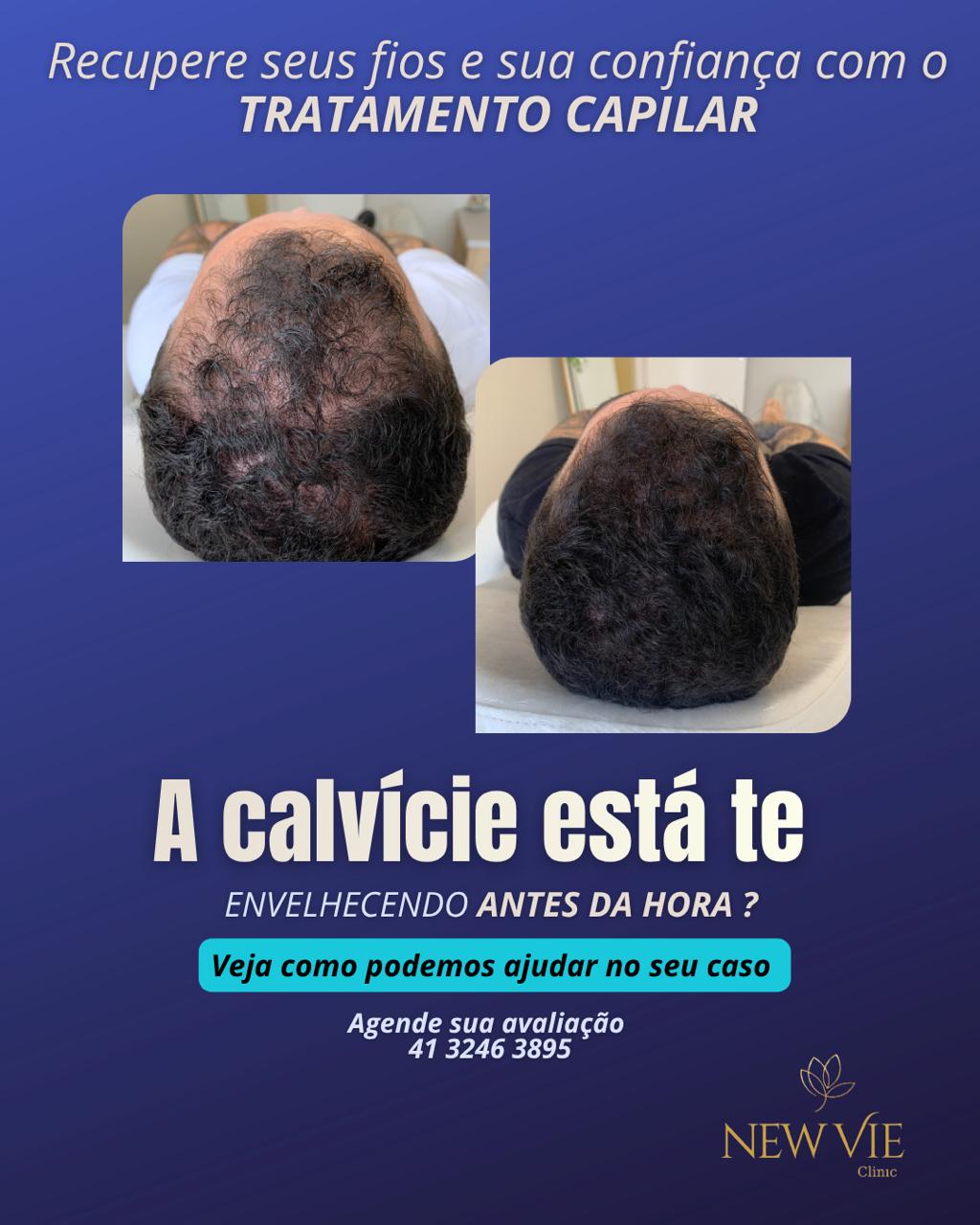 NewVie Clinic Facebook ad