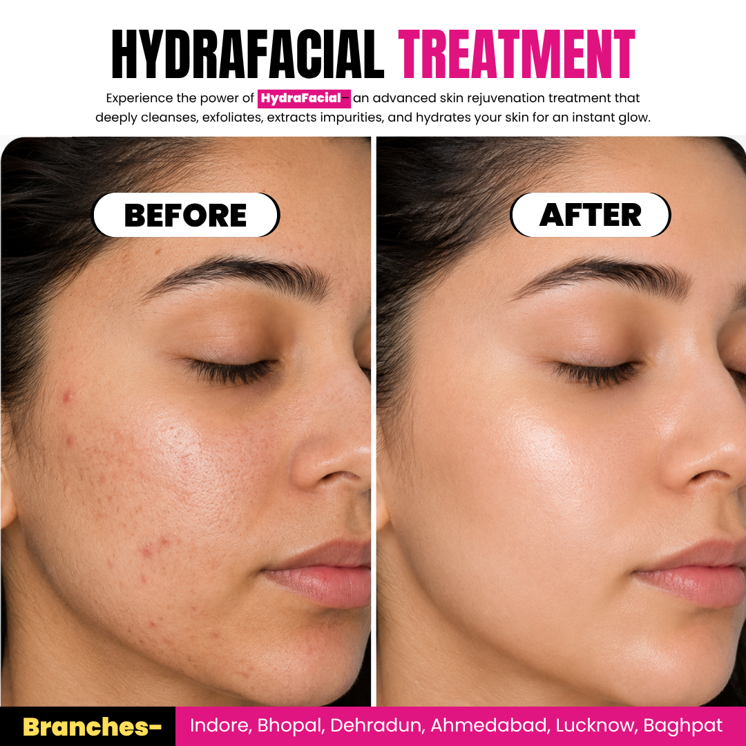 Mokosh Skin Hair Clinic Janjeerwala Indore Facebook ad