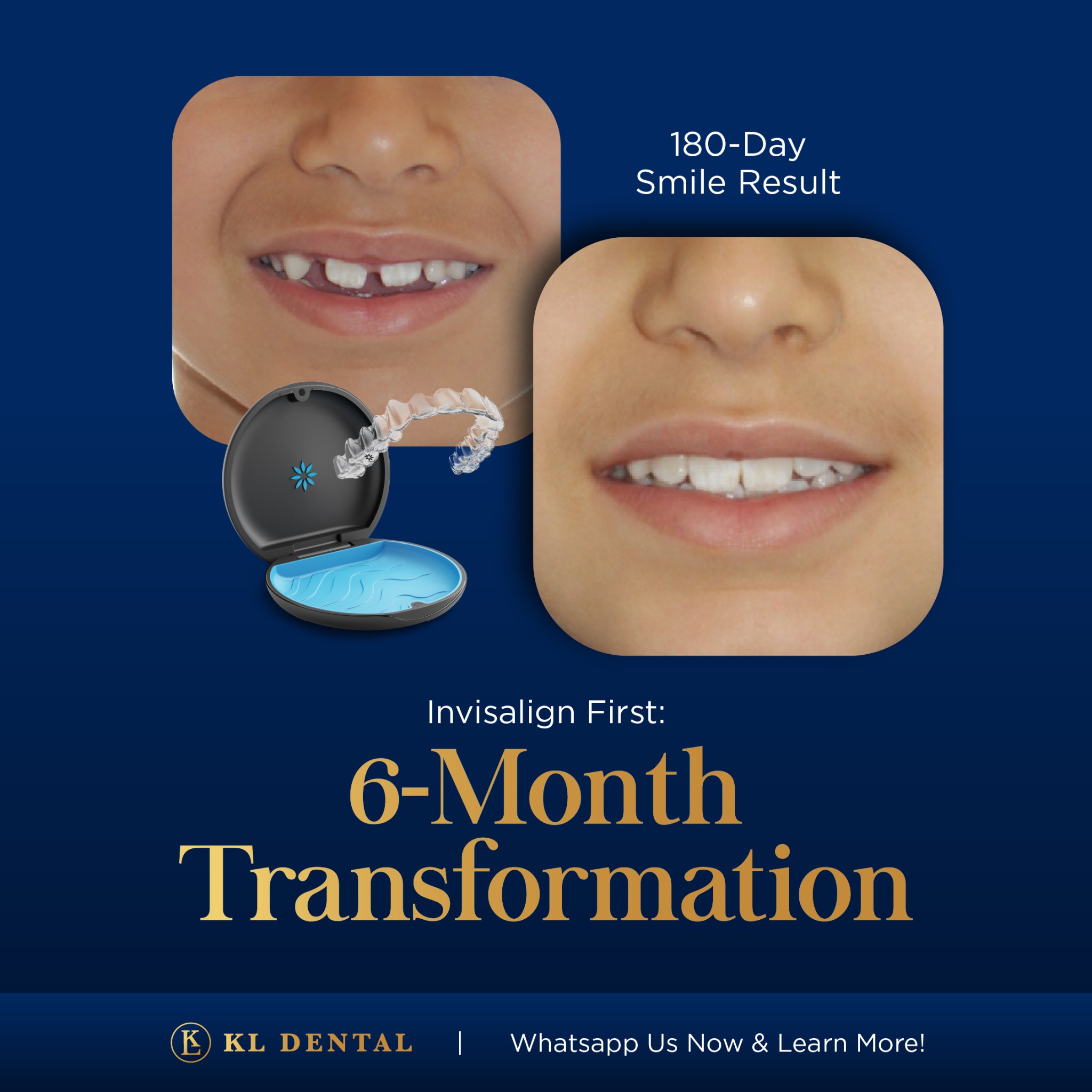 KL Dental Group Facebook ad
