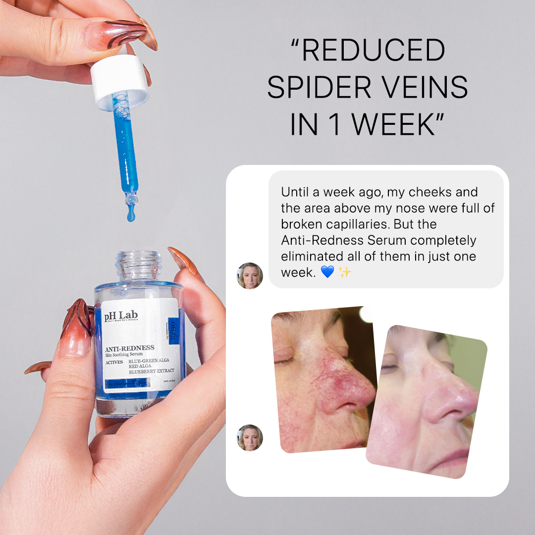 Anti-Redness US Facebook ad