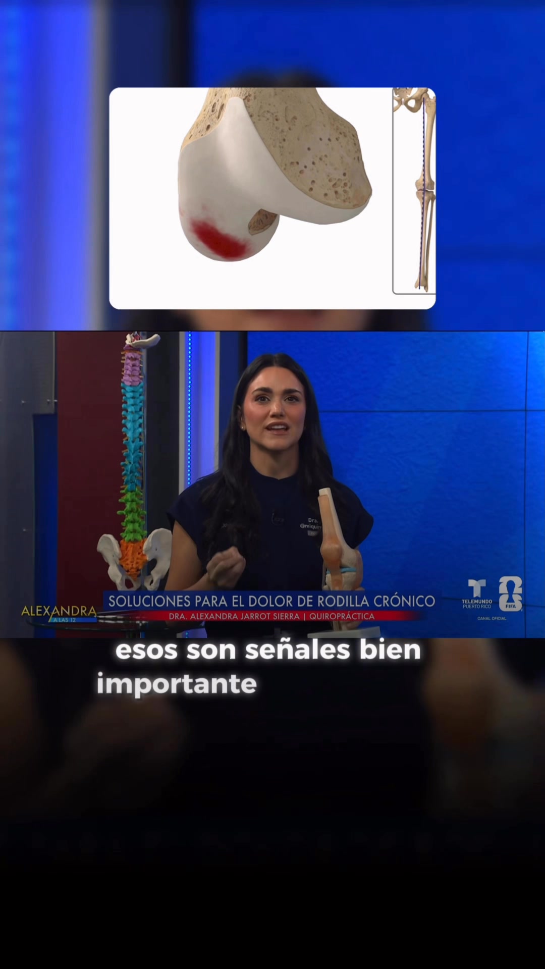Dra. Alexandra Jarrot Sierra Facebook ad: Dolor de rodilla