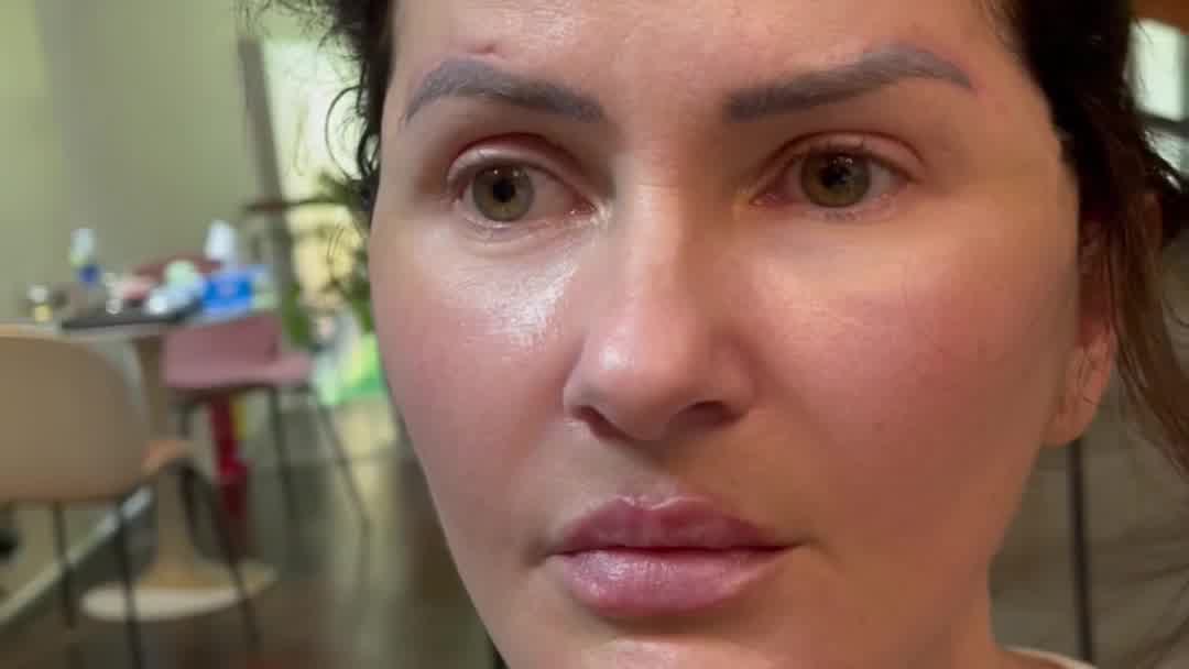 Dr Harvard Plastic Surgery Facebook ad from Mar 31, 2026
