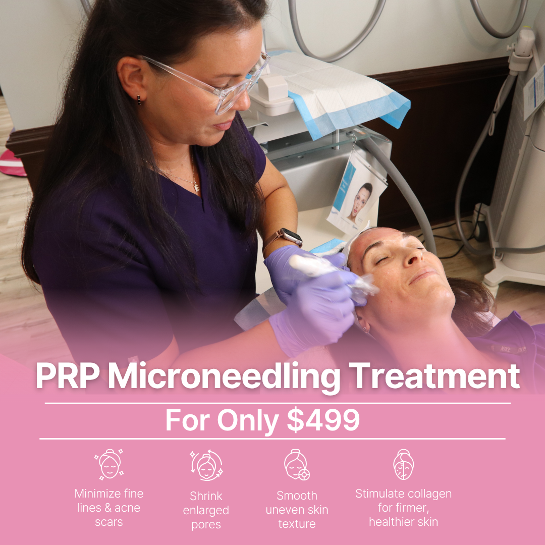 Aesthetically Yours Facebook ad: $499 PRP Microneedling Treatment!