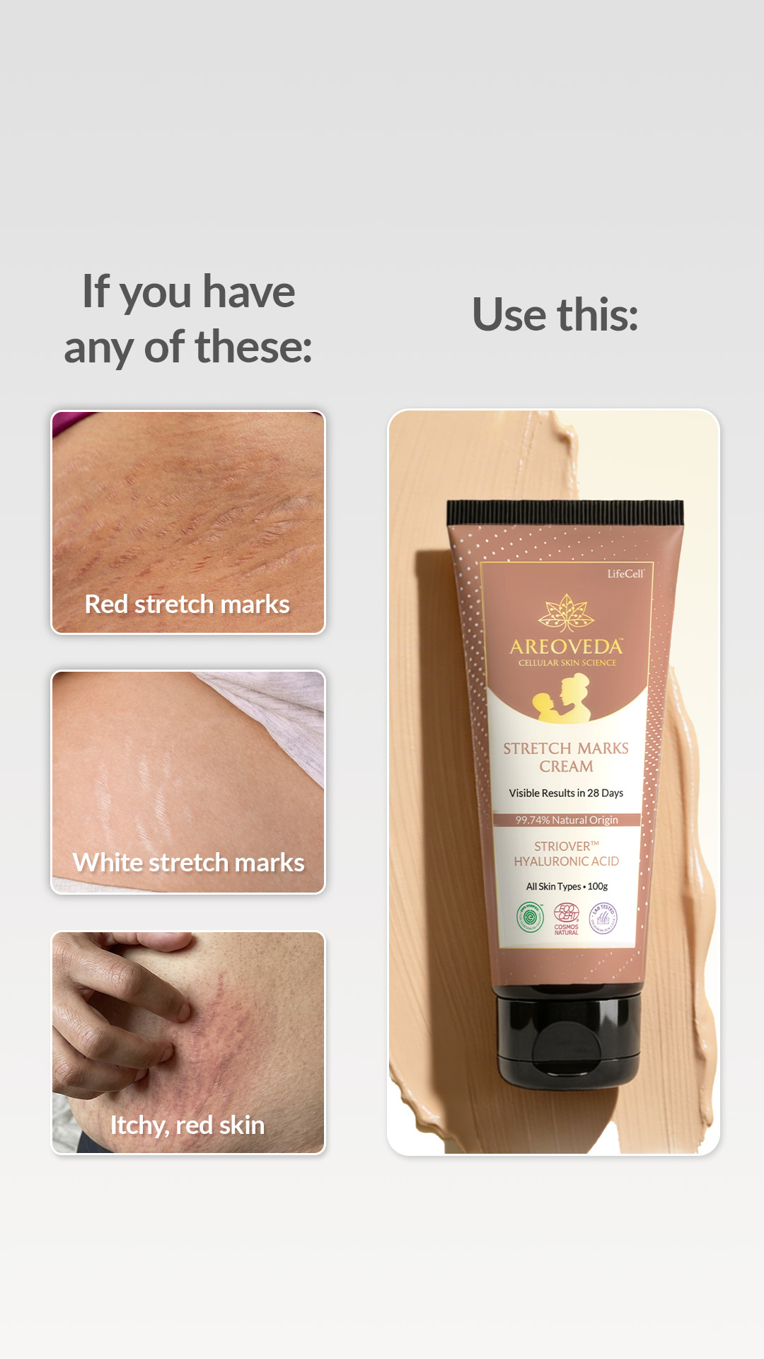 AreoVeda Facebook ad