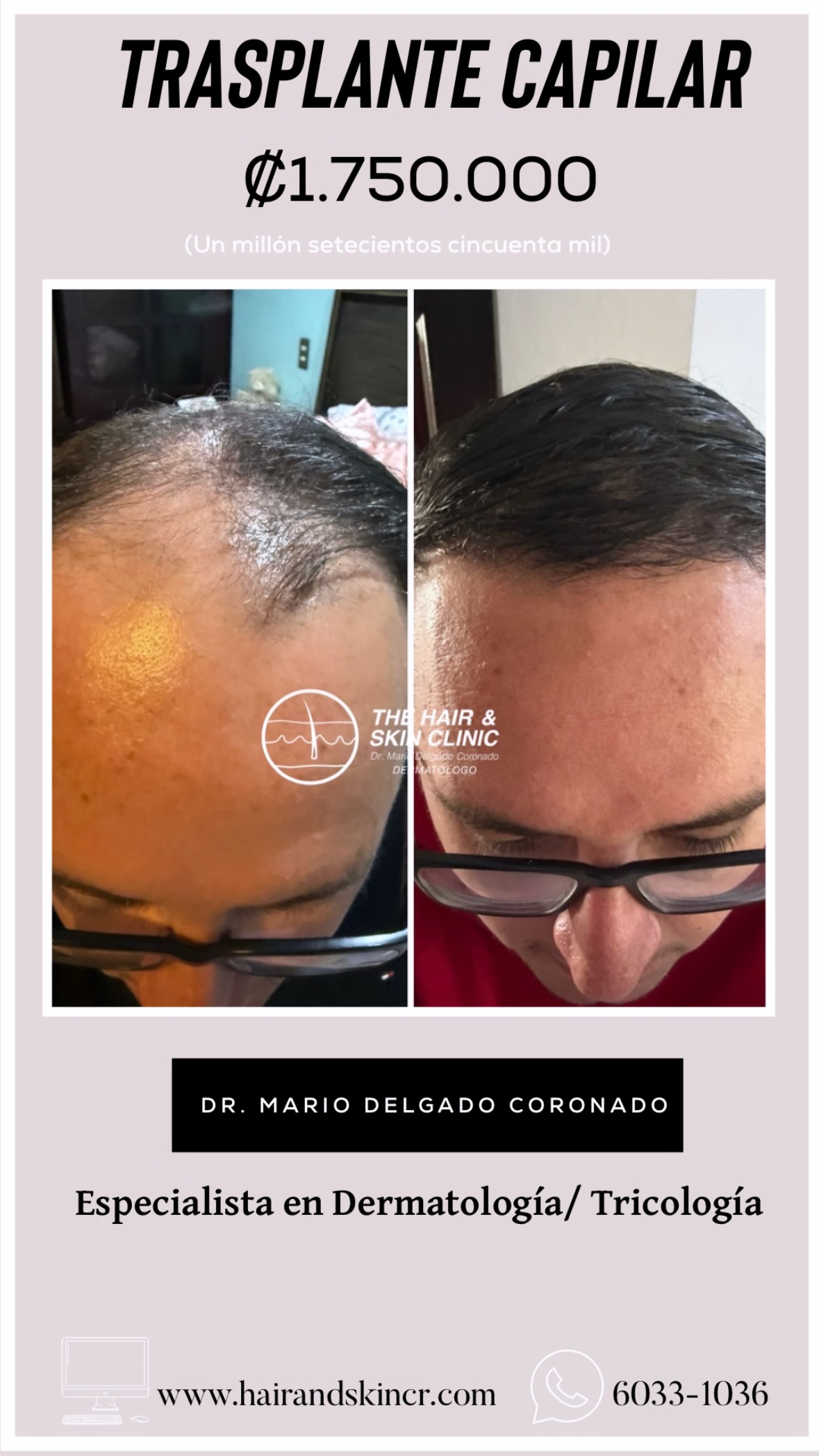 The Hair and Skin Clinic Facebook ad from Mar 30, 2026