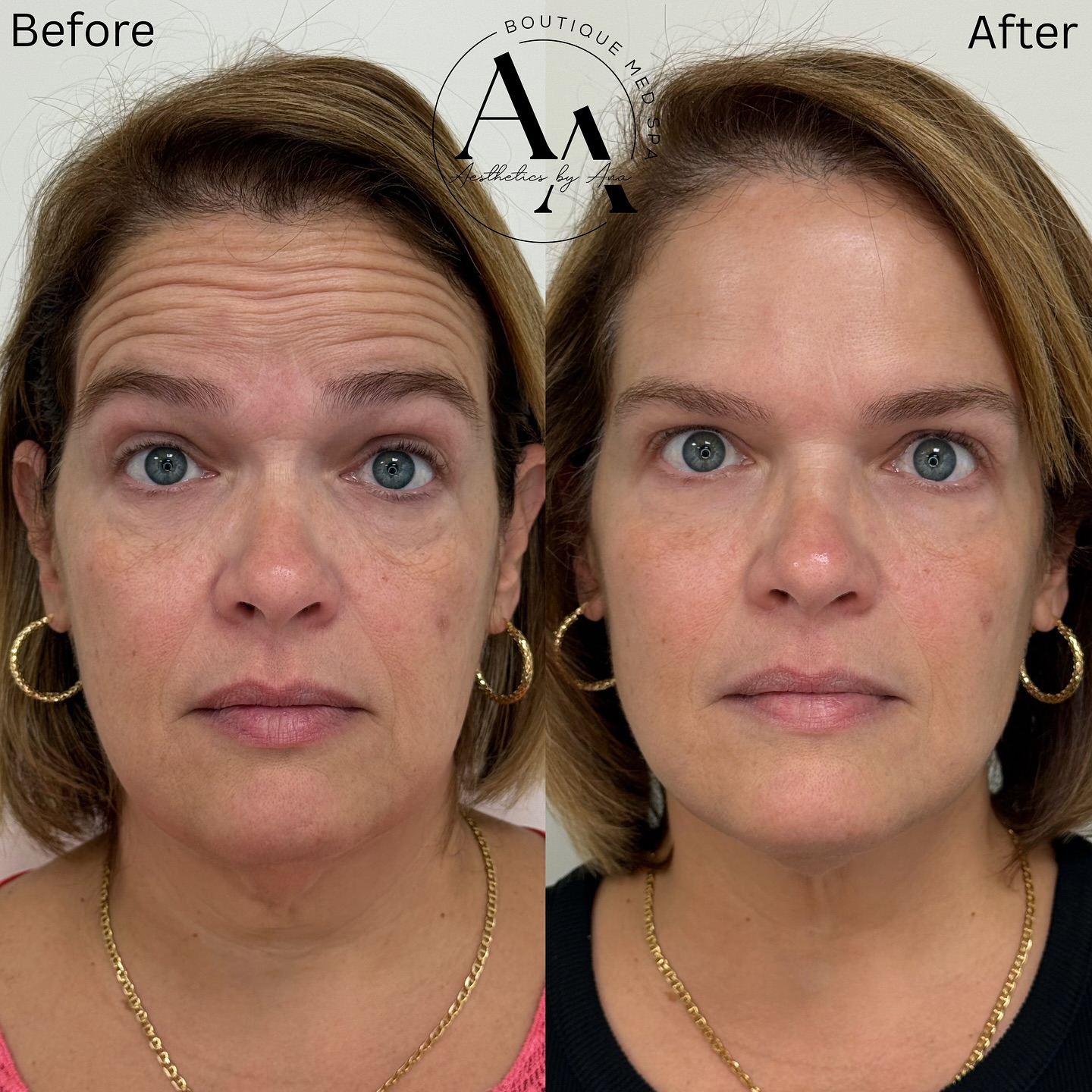 Aesthetics by Ana Facebook ad: Aesthetics by Ana is a boutique med spa…