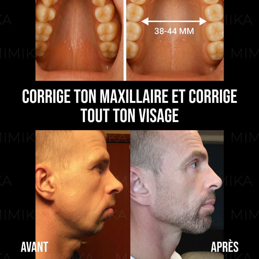 Mark Mewing Facebook ad