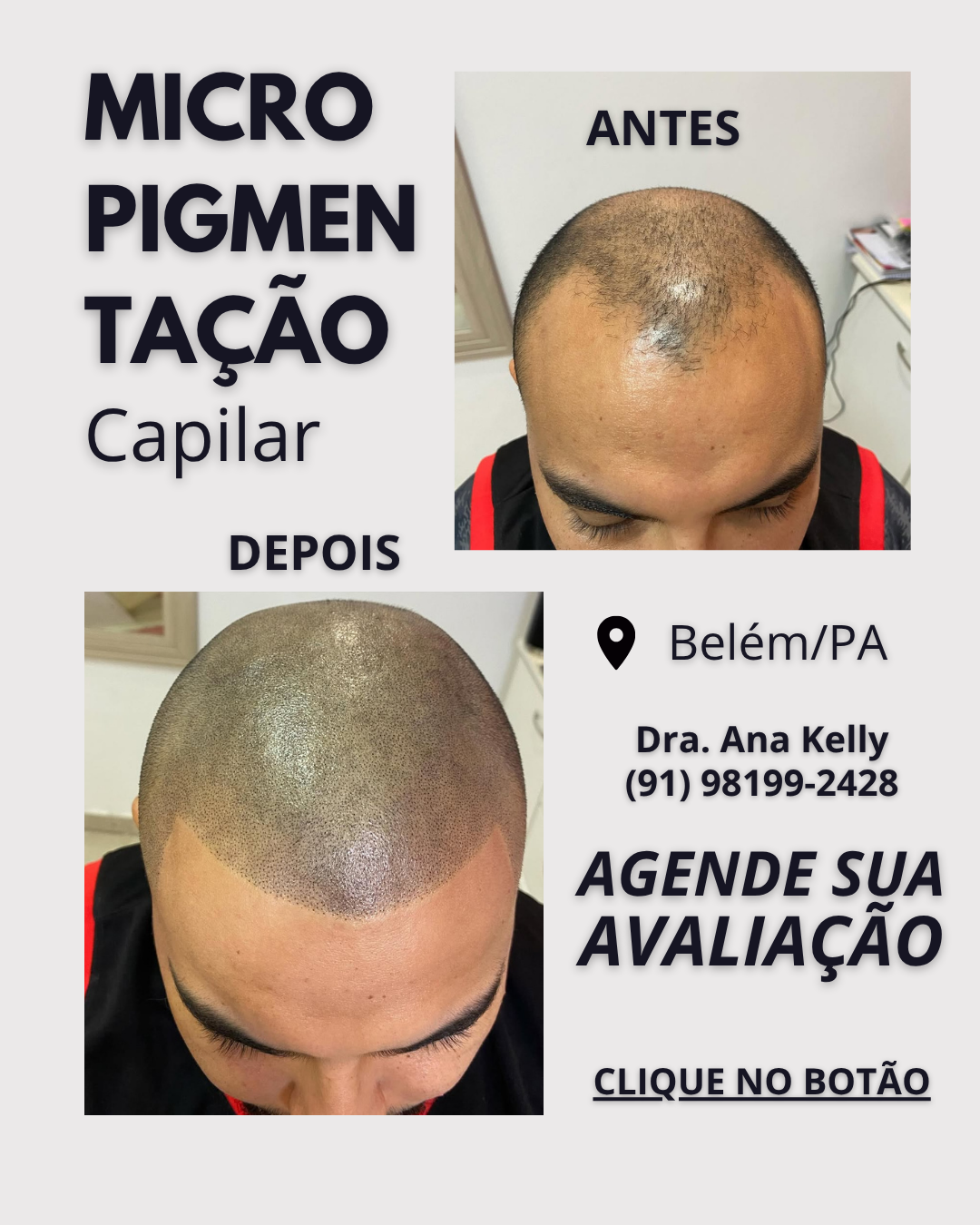 Ana Kelly Micropigmentação Facebook ad: Agende sua avaliação grátis