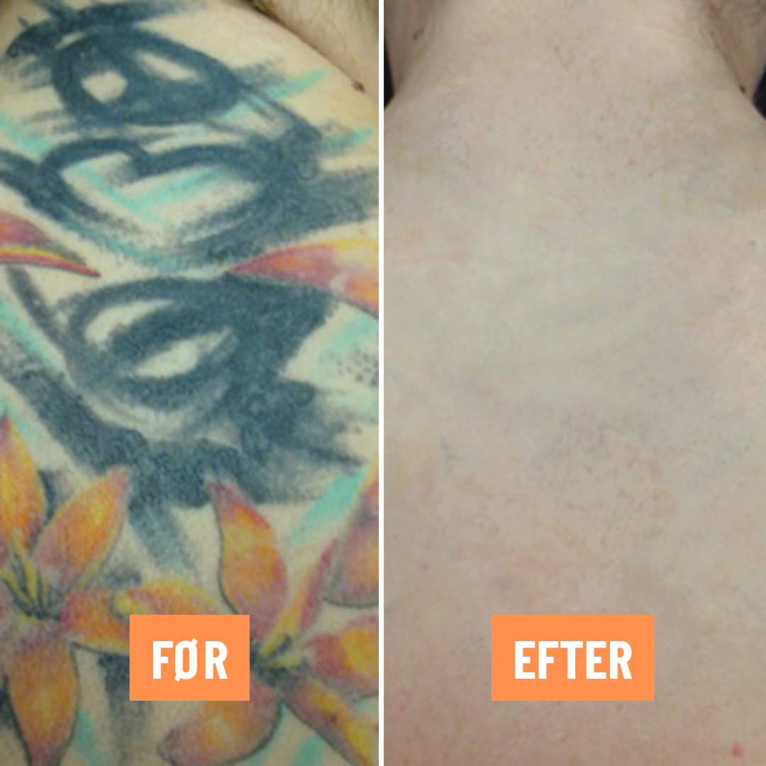 Clean Skin Studio Facebook ad: Jeg søger 7 personer, der er klar til…