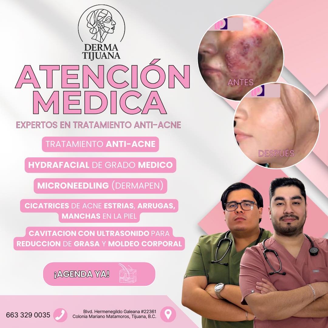 Derma Tijuana Facebook ad: ¡PROMOCIONES TODO EL MES!