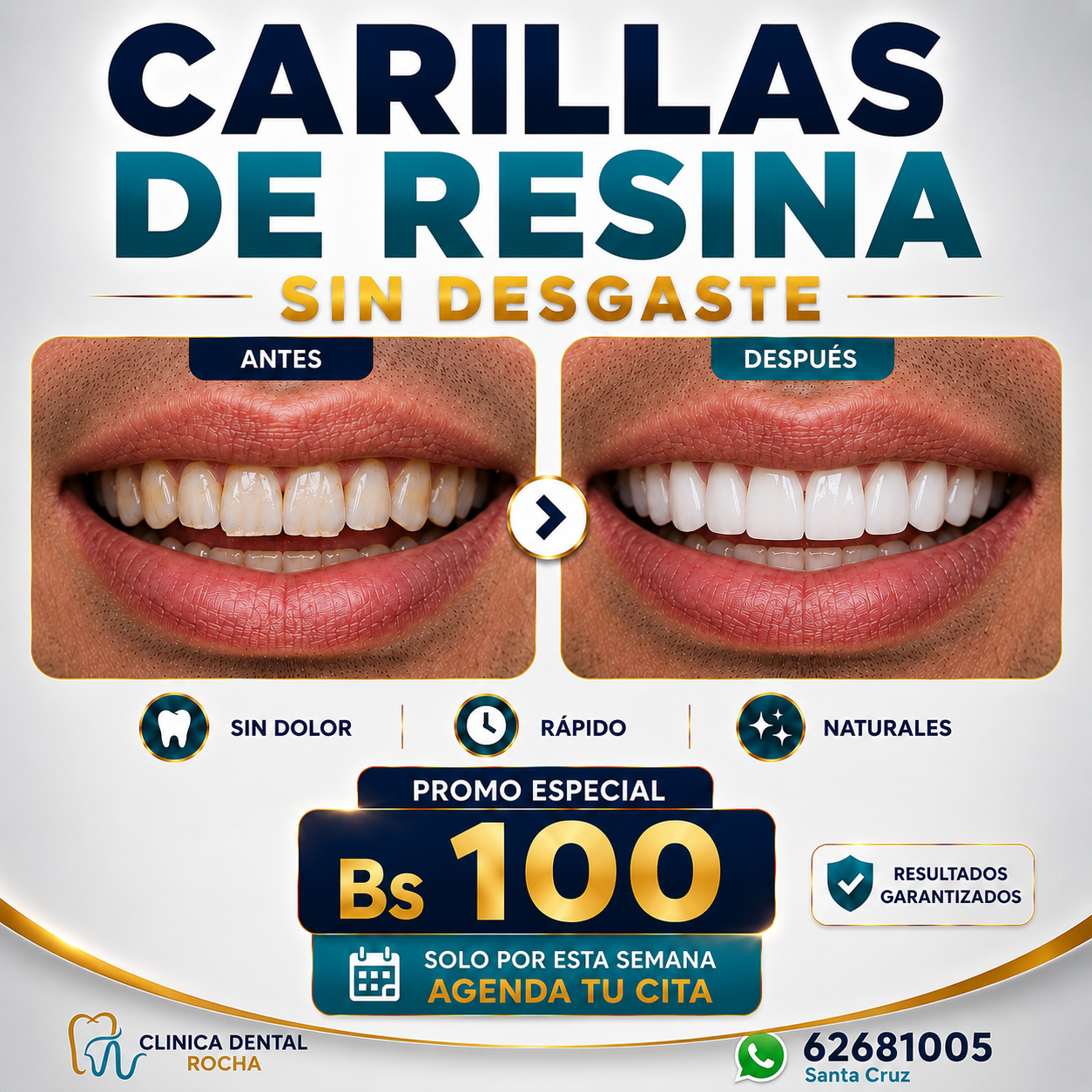 Consultorio Dental Rocha Facebook ad: ¡Tu nueva sonrisa comienza aquí